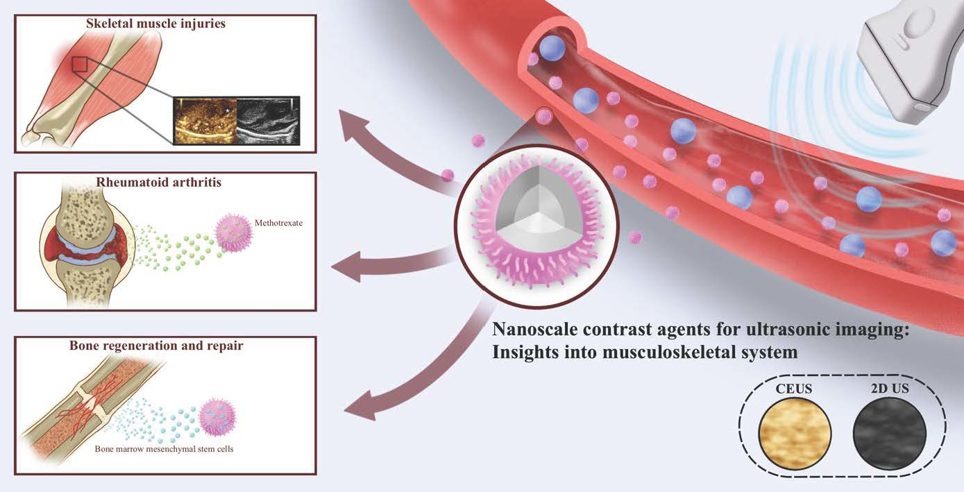 Diagnostics | Free Full-Text | Nanoscale Contrast Agents for Ultrasound ...