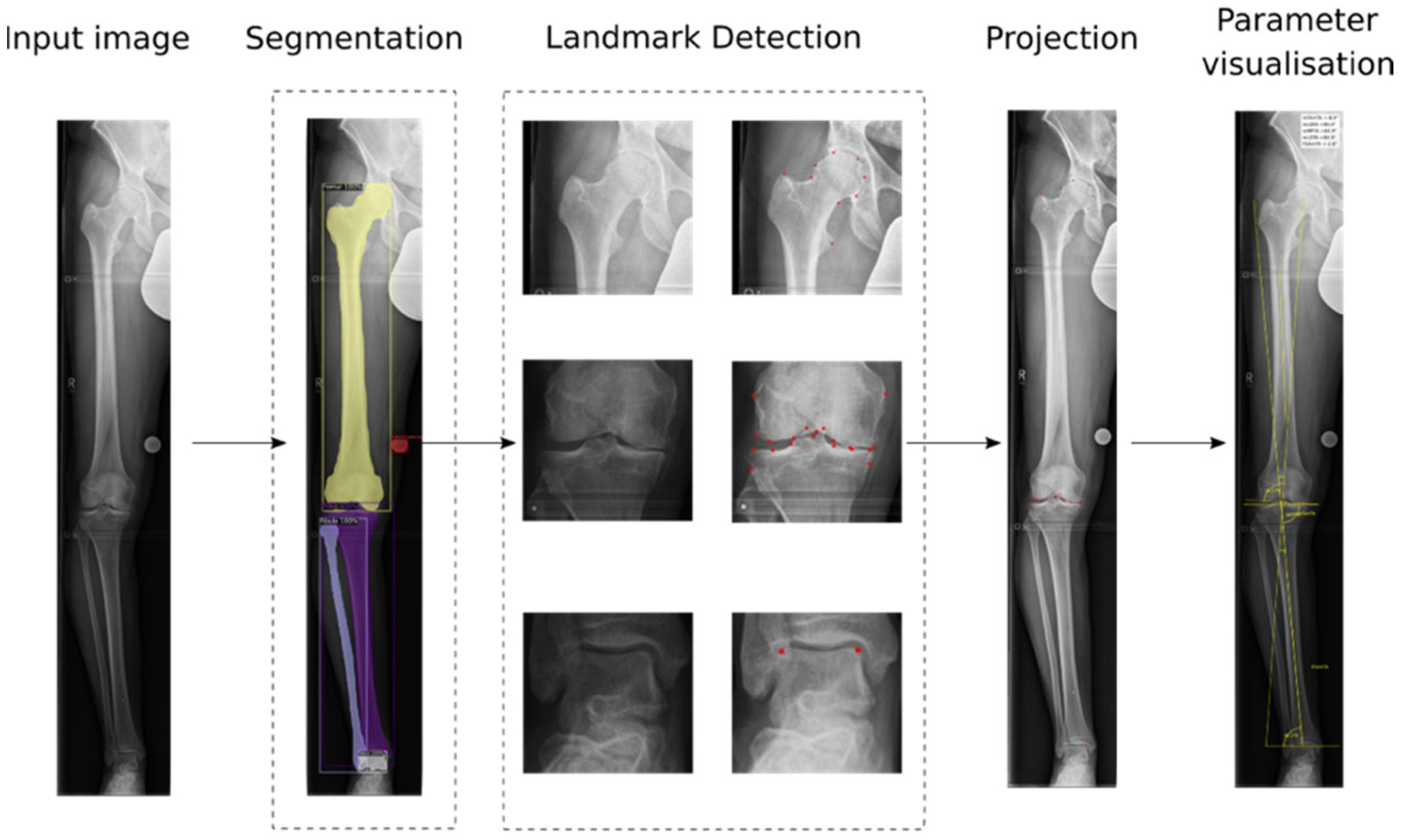 Automated Artificial Intelligence Based Assessment Of Lower Limb Automated Artificial Intelligence Based Assessment Of Lower Limb