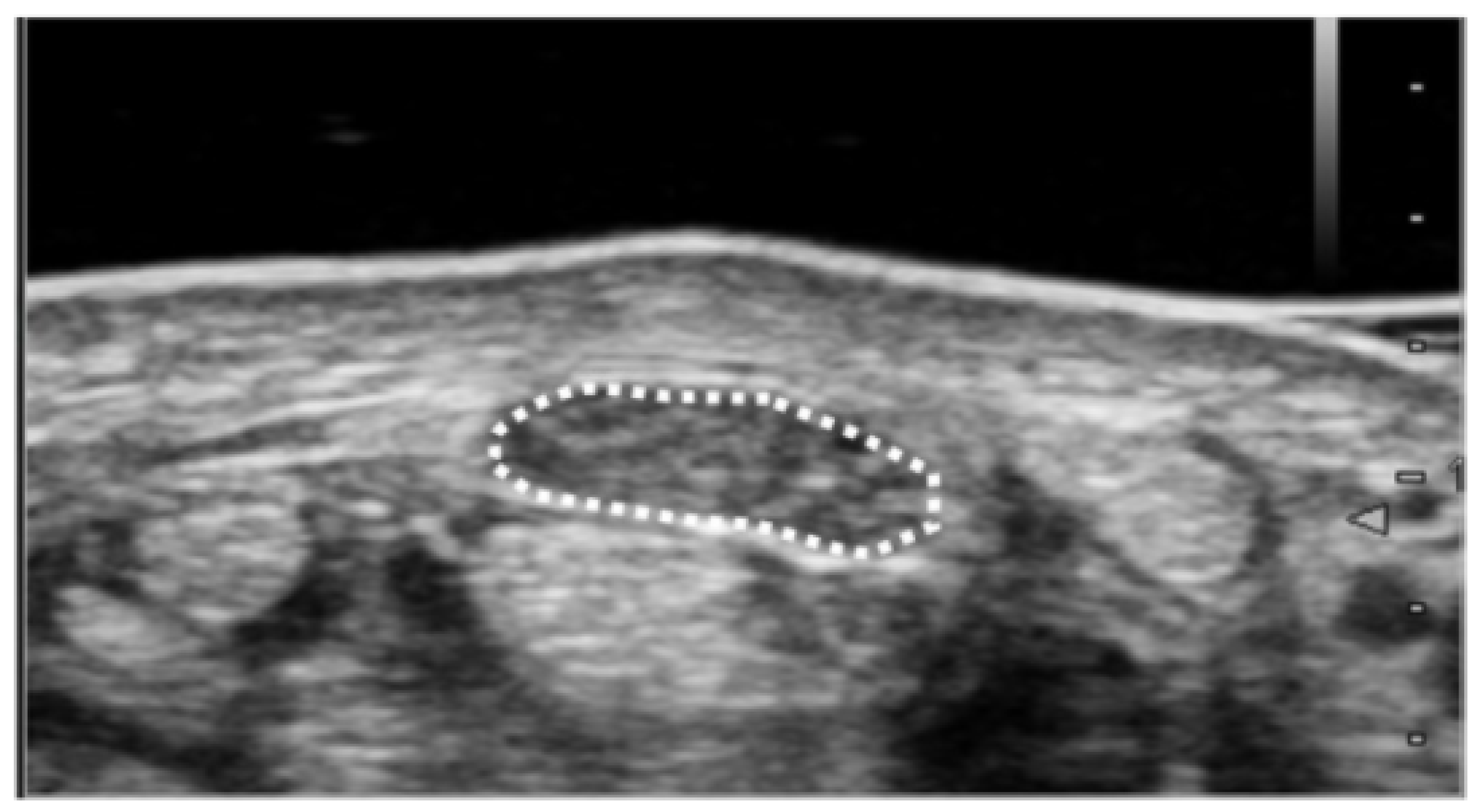 Diagnostics Free Full Text Clinical Relevance Of Ultrasonographic