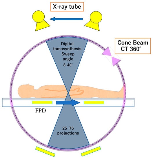 Diagnostics | Free Full-Text | Advances In Bone Joint Imaging-Metal ...