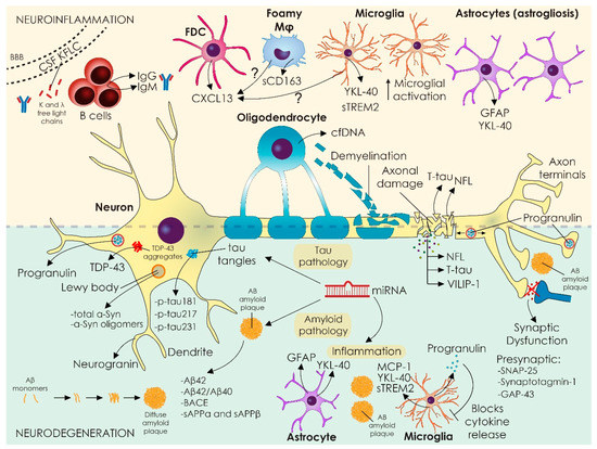 Diagnostics | Free Full-Text | Novel CSF Biomarkers Tracking Autoimmune ...