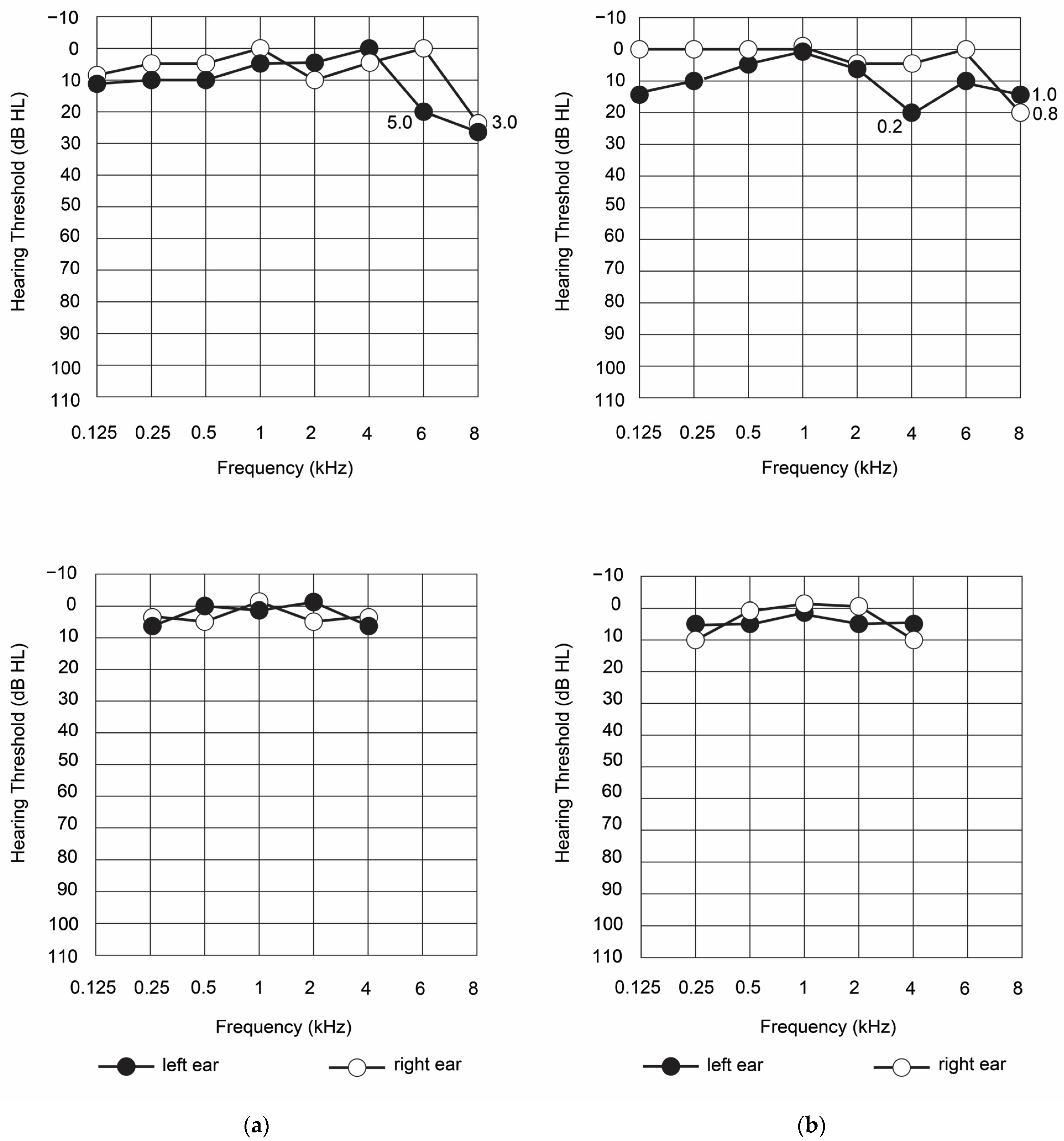 diagnostics-free-full-text-assessment-of-hearing-and-vestibular