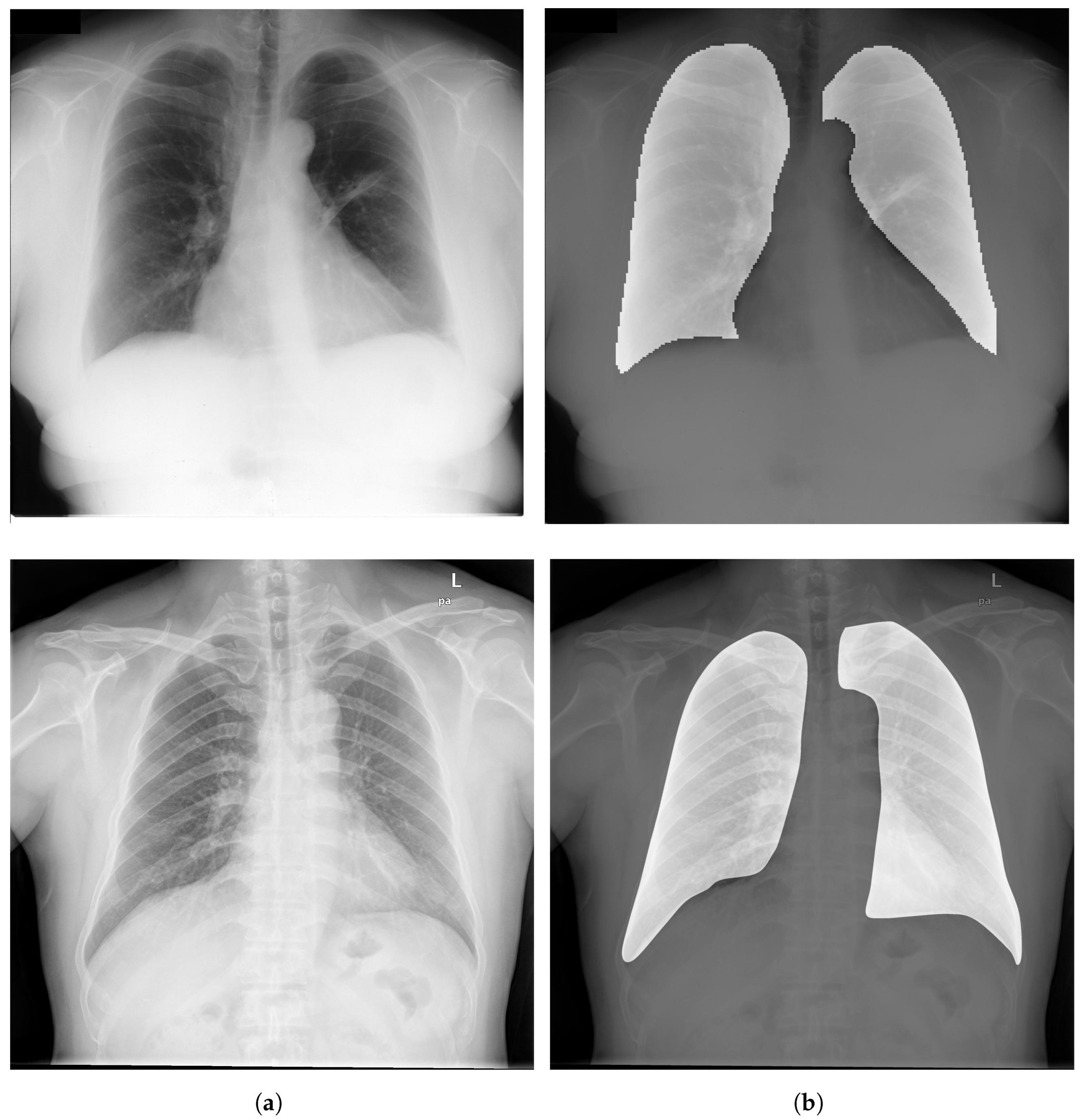 Diagnostics | Free Full-Text | A Review of Recent Advances in Deep Learning  Models for Chest Disease Detection Using Radiography