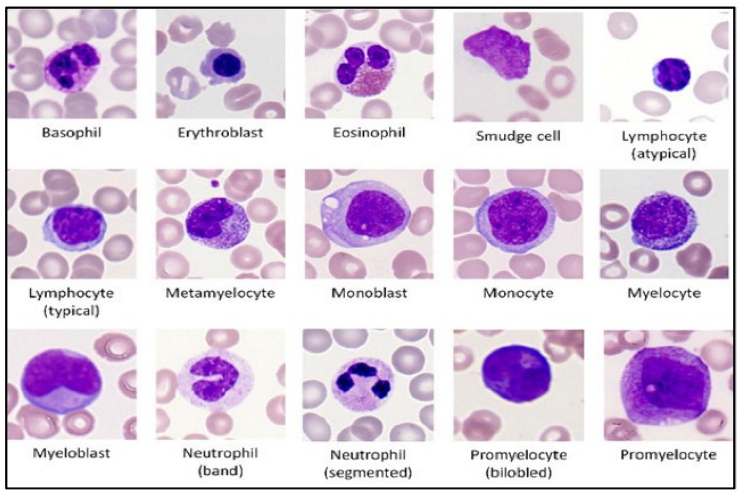 Diagnostics Free Full Text Classification Of Atypical White Blood