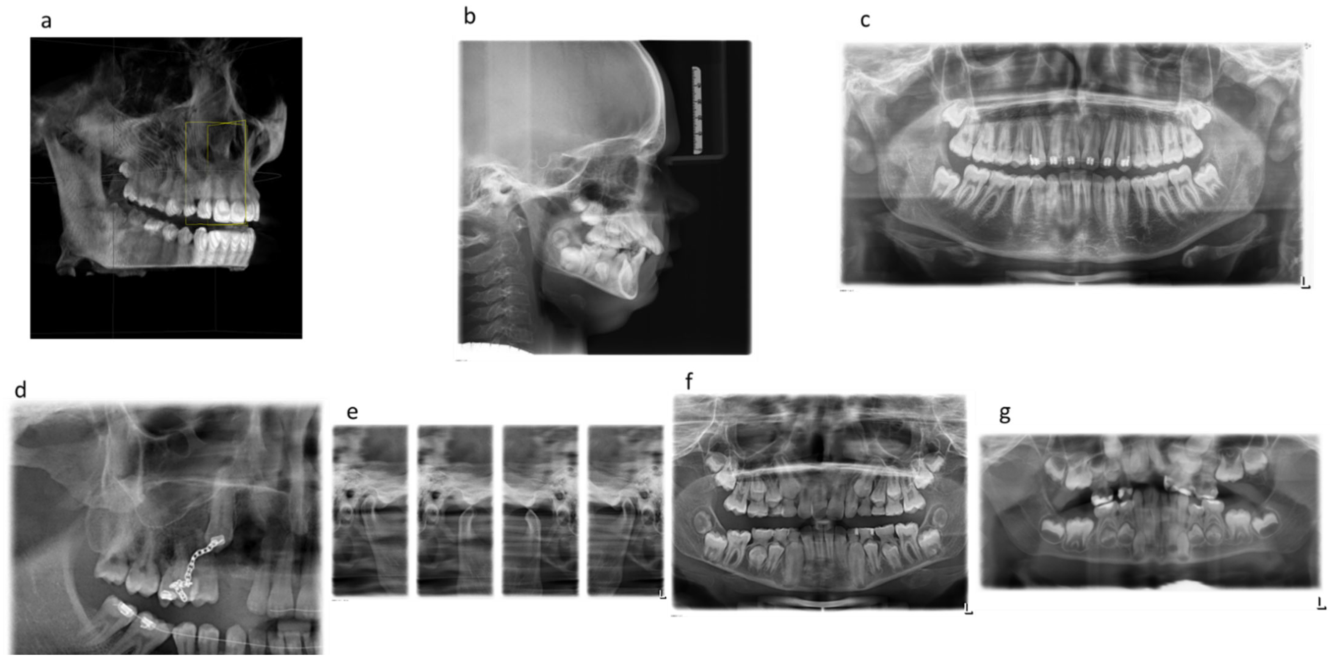 Cross Section X Ray Cartoon Porn - Diagnostics | Free Full-Text | Frequency of Dental X-ray Diagnostics in  Children and Adolescents: What Is the Radiation Exposure?