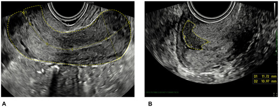 Diagnostics | Free Full-Text | Prognostic Significance of Ultrasound ...