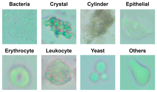 diagnostics-free-full-text-automatic-classification-of-particles-in