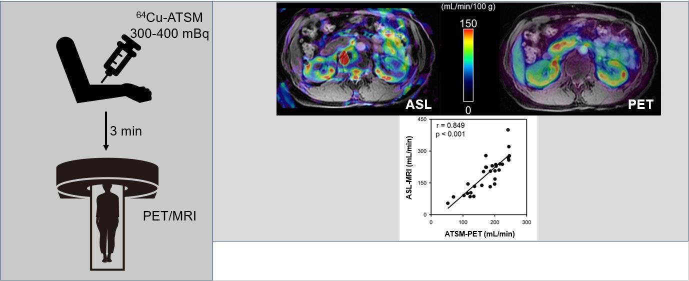 Diagnostics | Free Full-Text | Feasibility of Renal Blood Flow