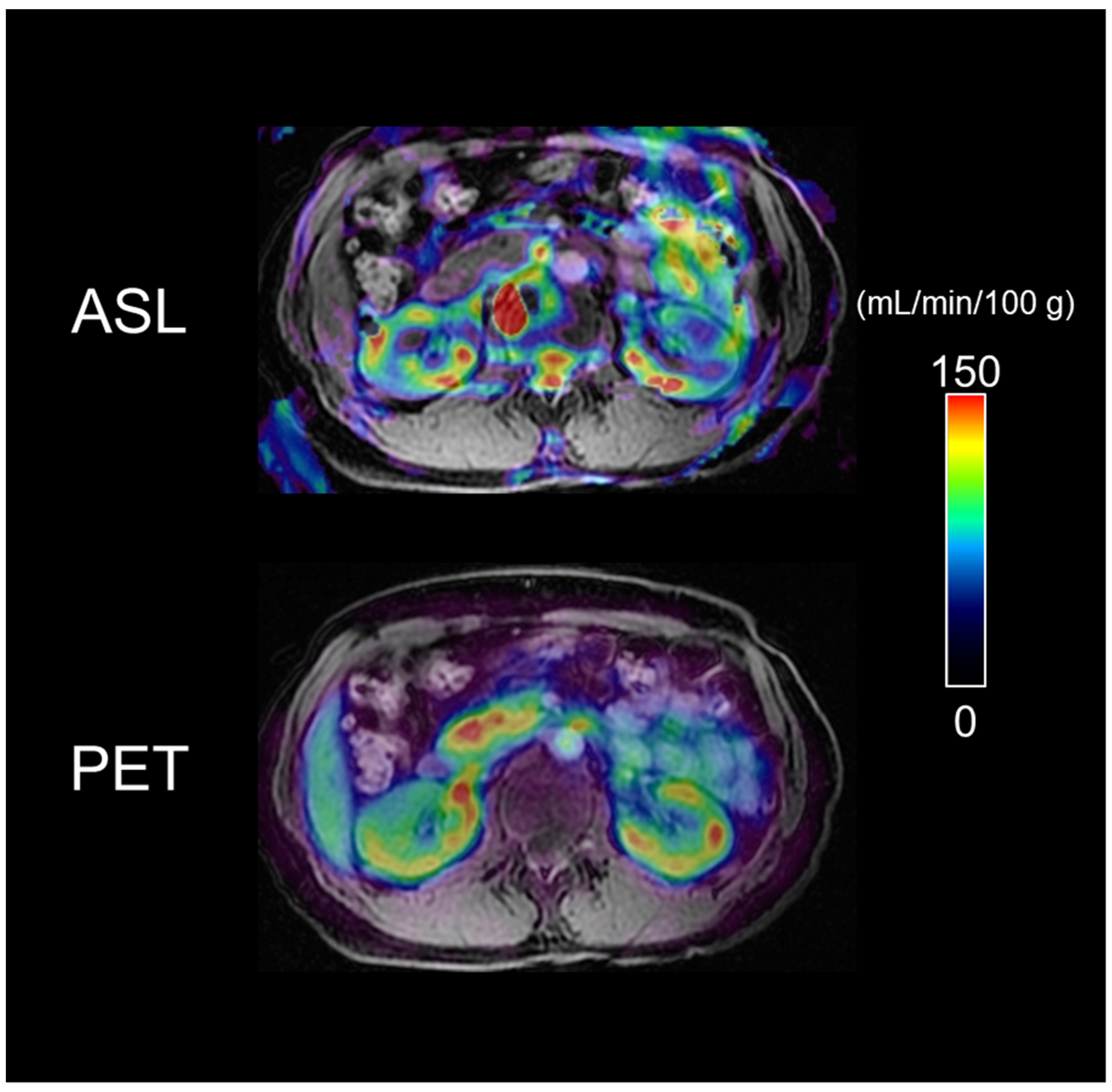 Diagnostics | Free Full-Text | Feasibility of Renal Blood Flow