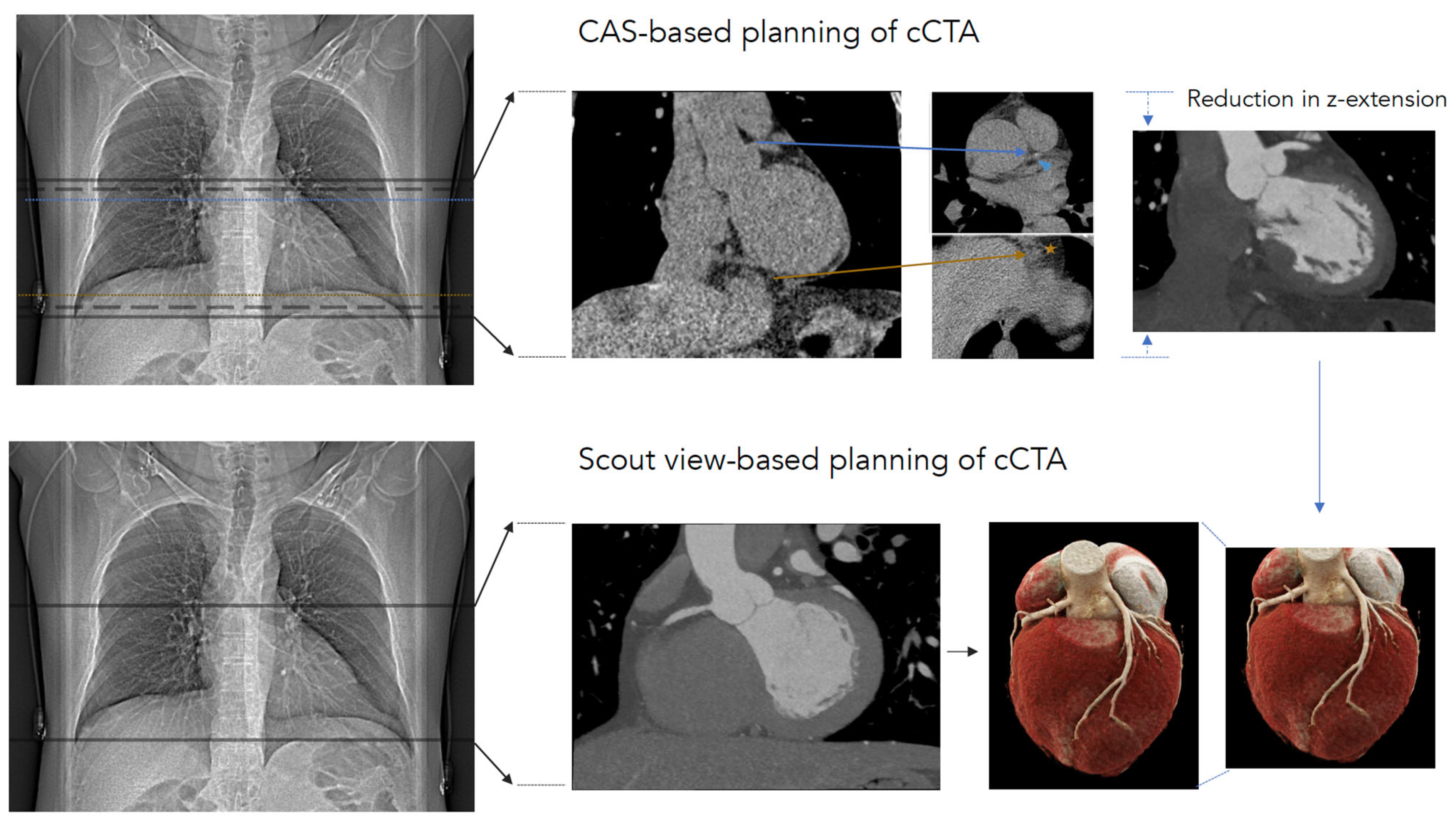 Contrast Media with and without Calcium for Cardioangiography in