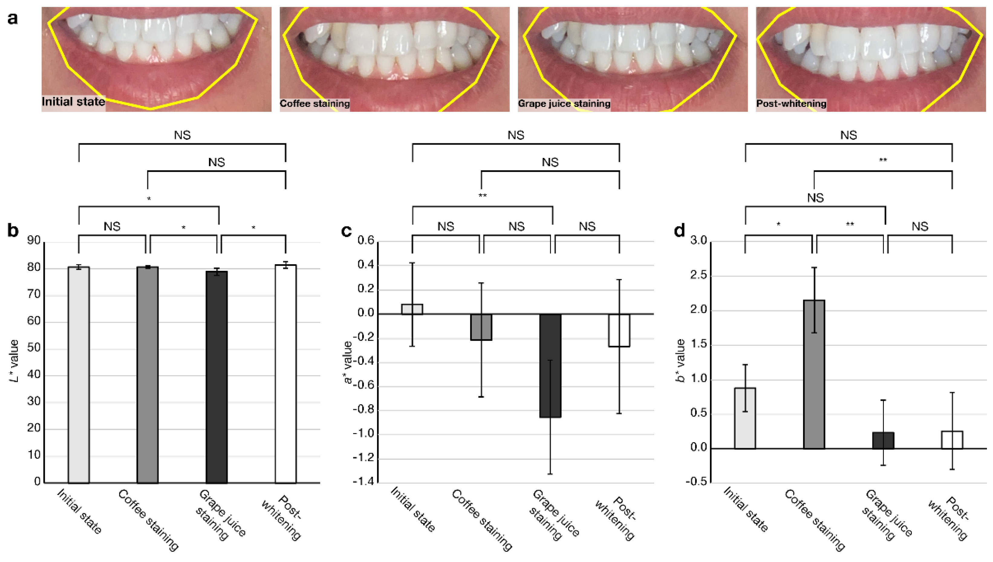 Diagnostics | Free Full-Text | Correction: Kusayanagi et al. A