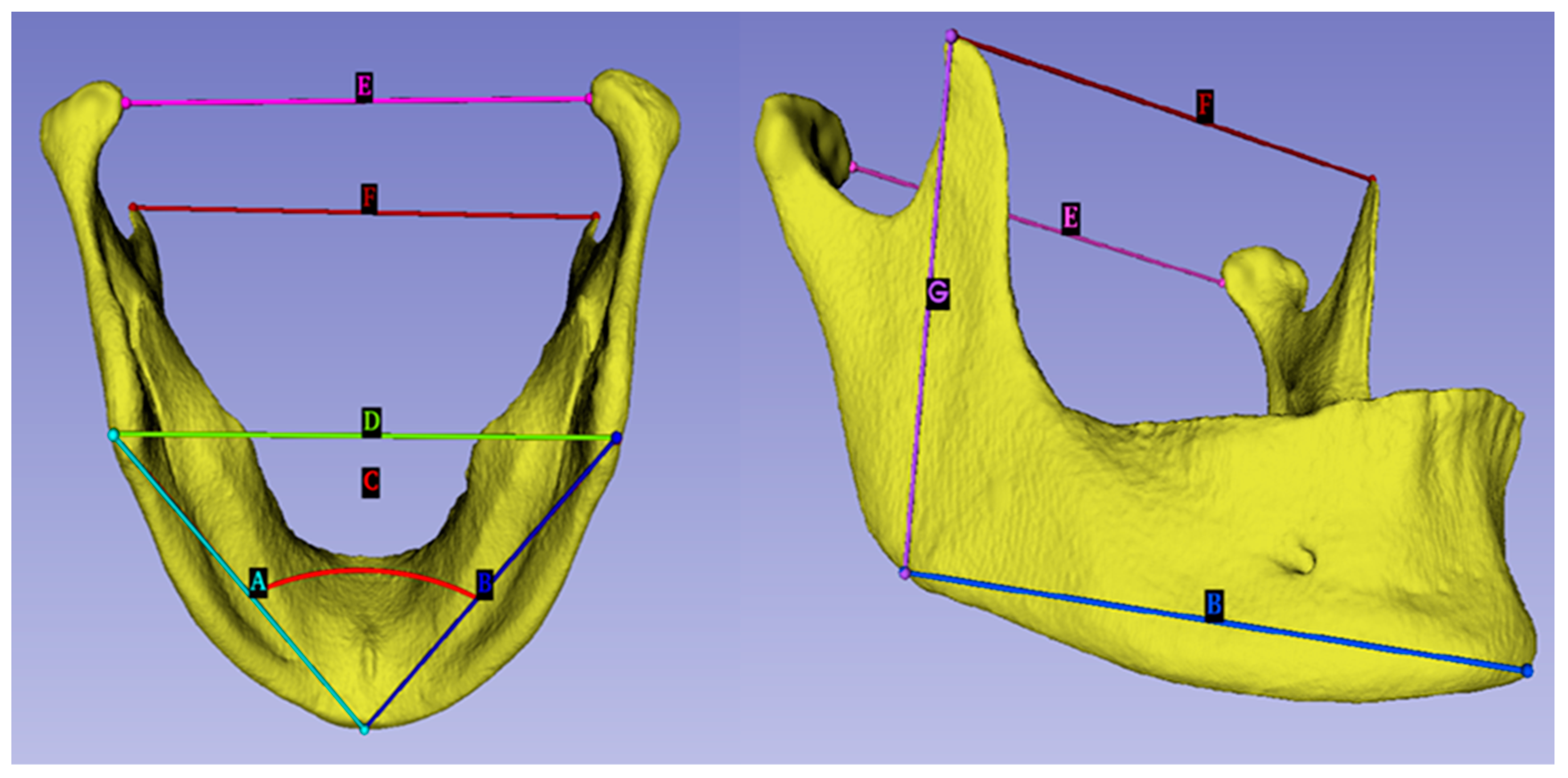 Solved ACTIVITY 2: SEX DETERMINIATION FROM PELVIC MORPHOLOGY