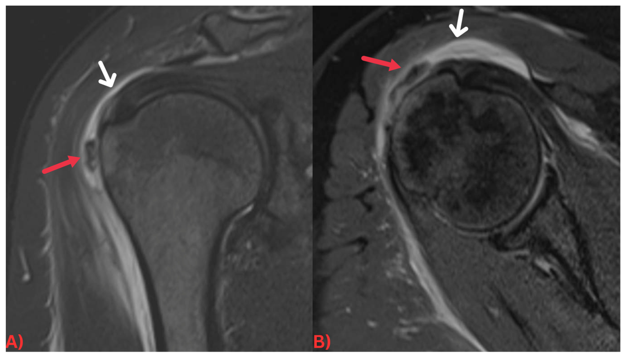 Radiological identification and analysis of soft tissue musculoskeletal  calcifications, Insights into Imaging
