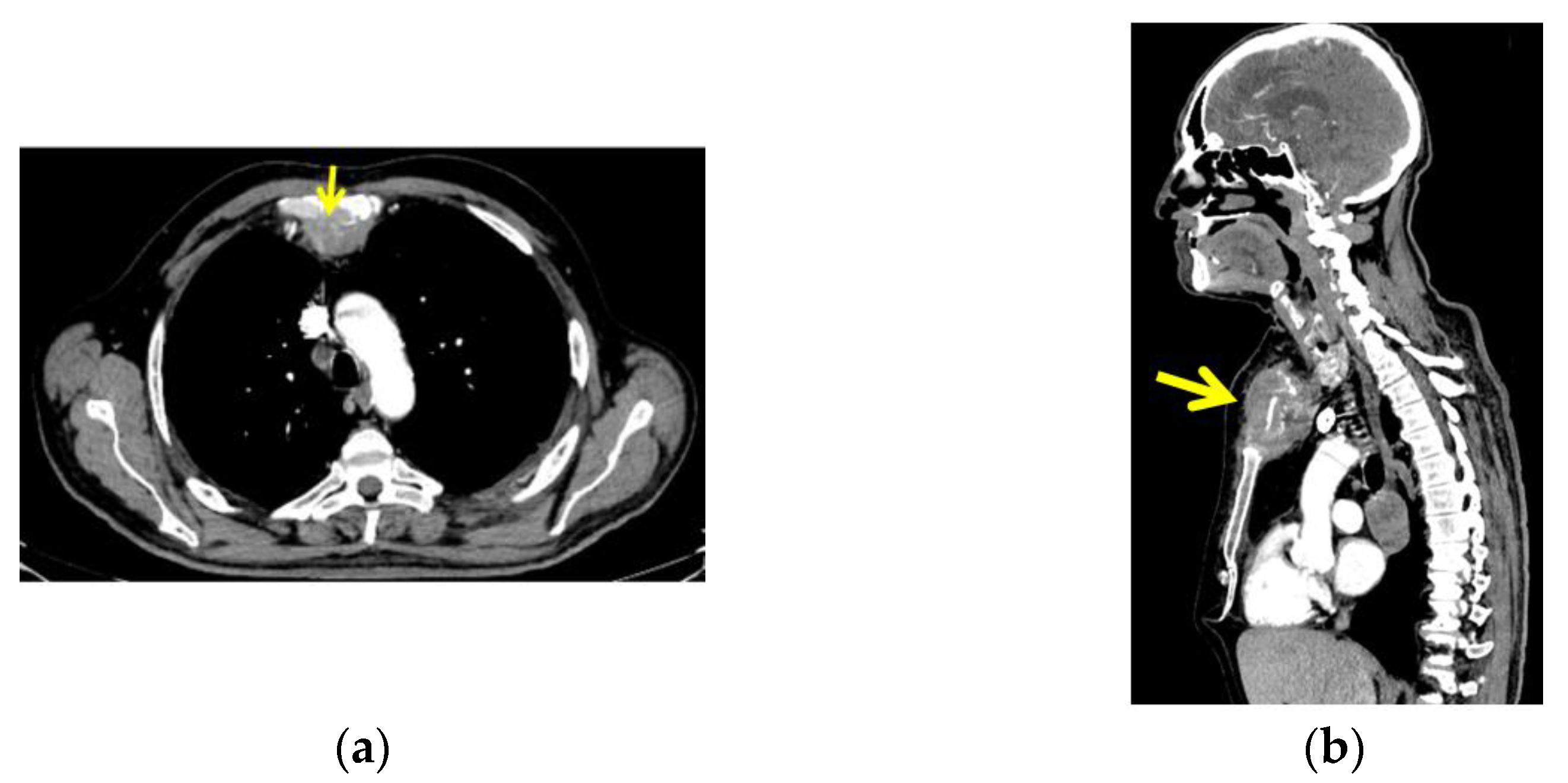 https://pub.mdpi-res.com/diagnostics/diagnostics-13-02698/article_deploy/html/images/diagnostics-13-02698-g004.png?1692862164