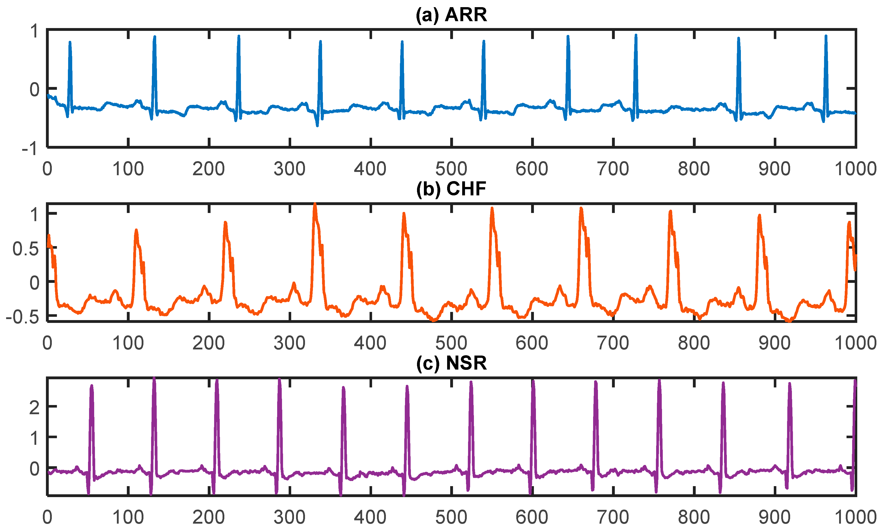 Diagnostics | Free Full-Text | Deep-Learning-Based Arrhythmia Detection ...