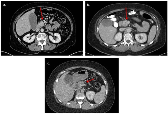 Diagnostics | Free Full-Text | Staging Computed Tomography Parameters ...