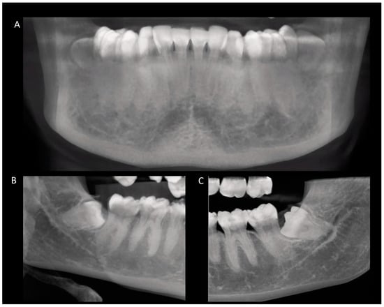 Spatial Position and Anatomical Characteristics Associated with ...