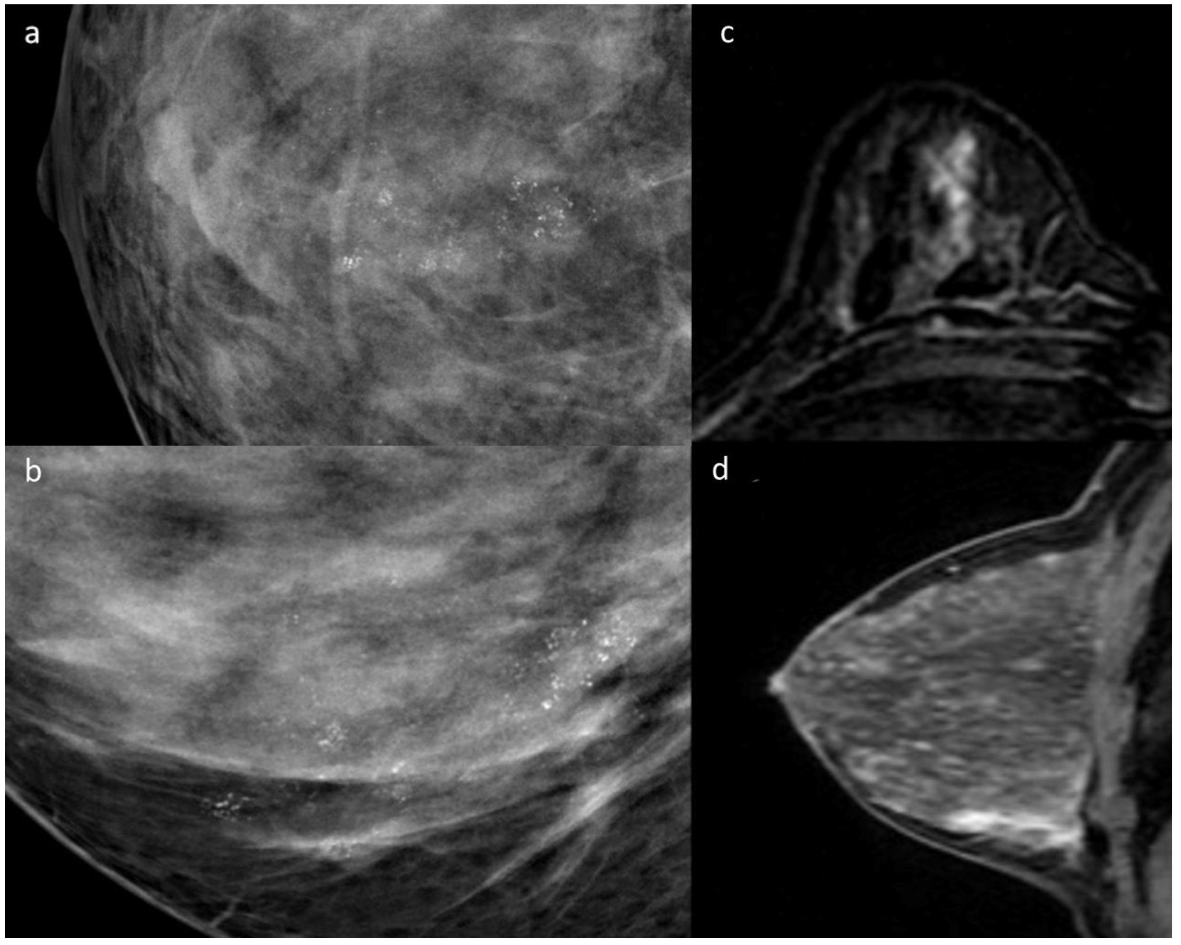 Diagnostics | Free Full-Text | Digital Mammography (DM) Vs. Dynamic ...