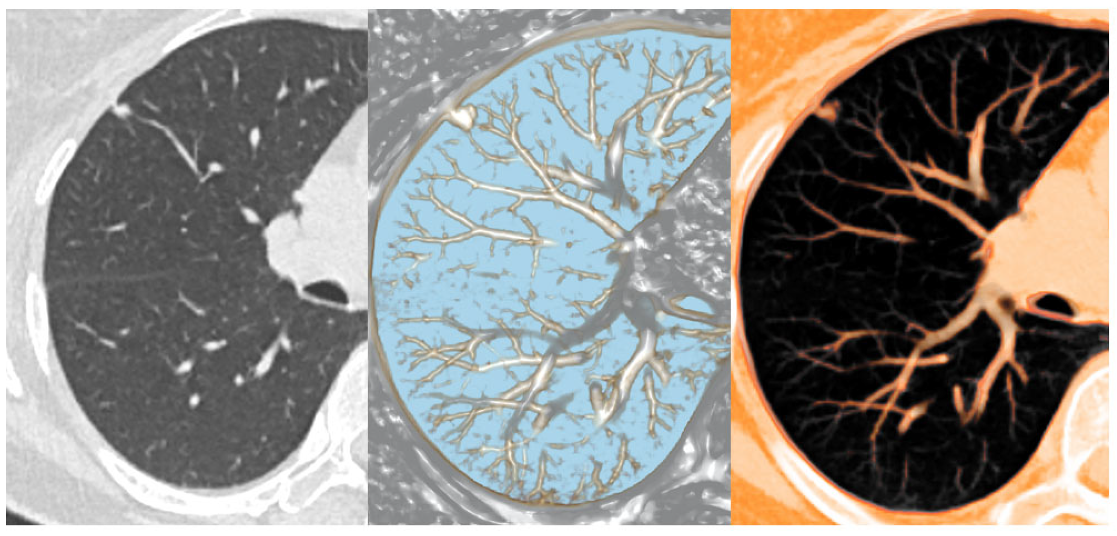 Optimizing Layer Thickness in Multi-Planar Volume Reconstruction for ...