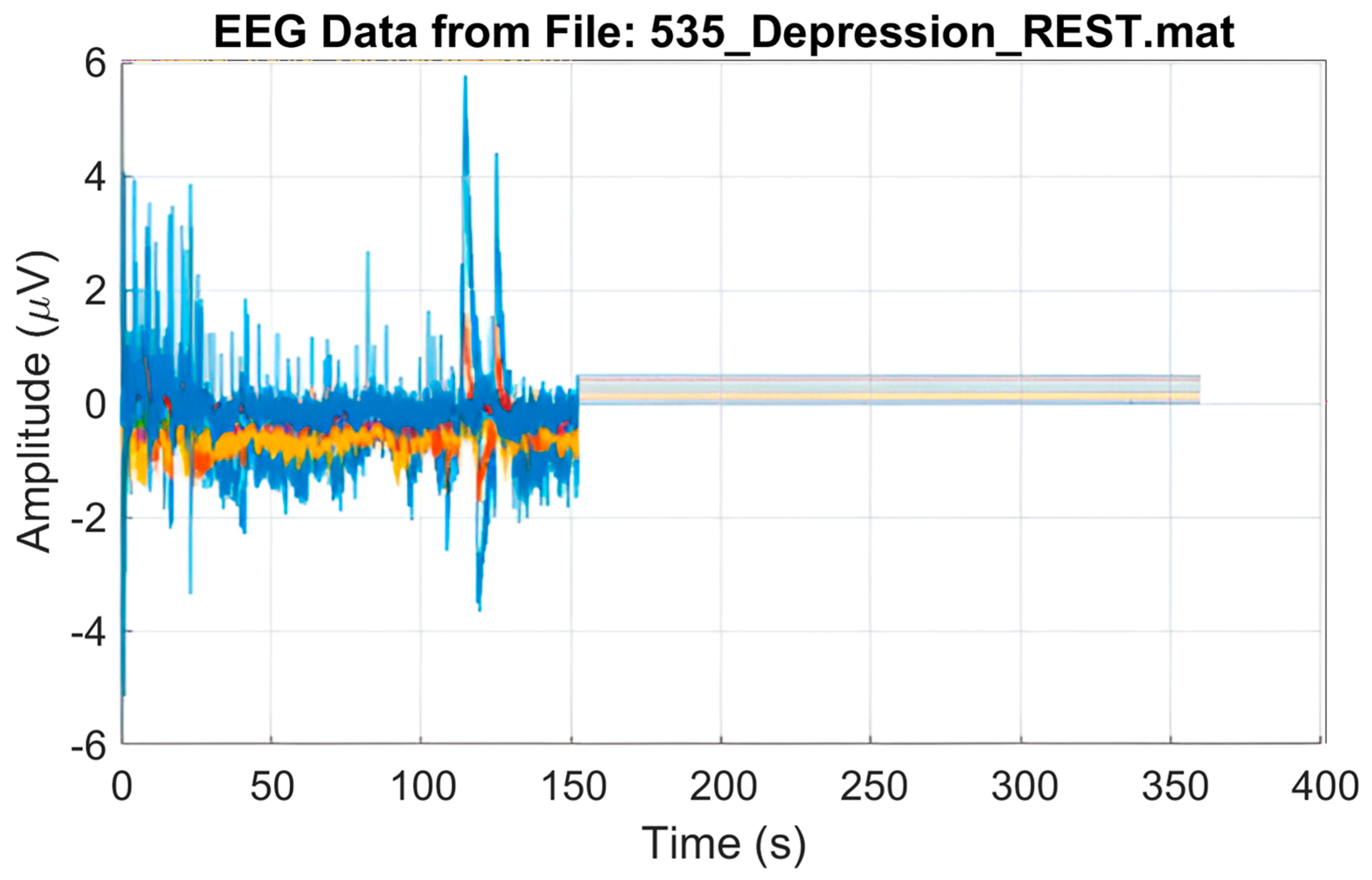 MS-MDDNet: A Lightweight Deep Learning Framework for Interpretable EEG ...