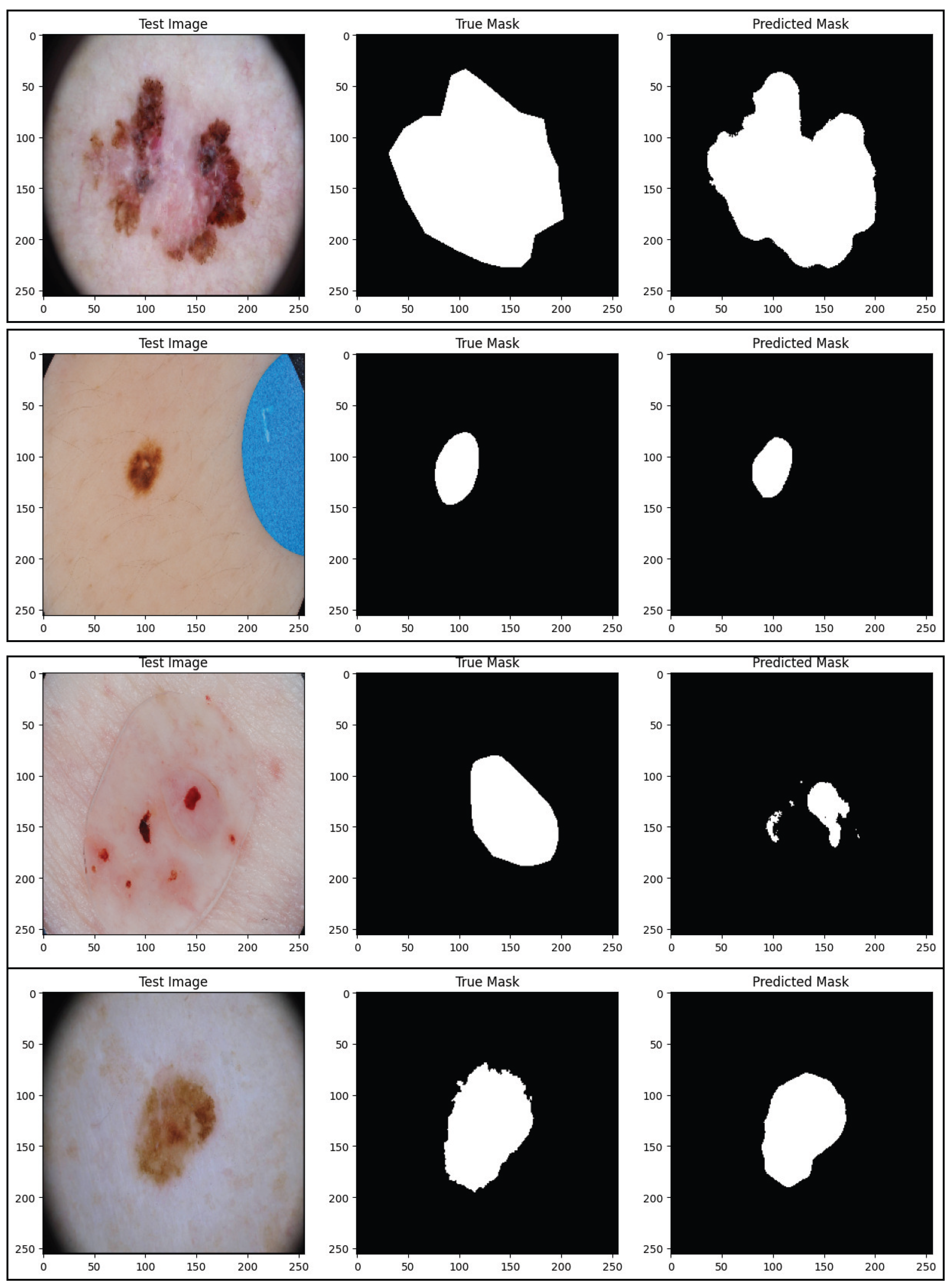 Foundation-Model-Driven Skin Lesion Segmentation and Classification ...
