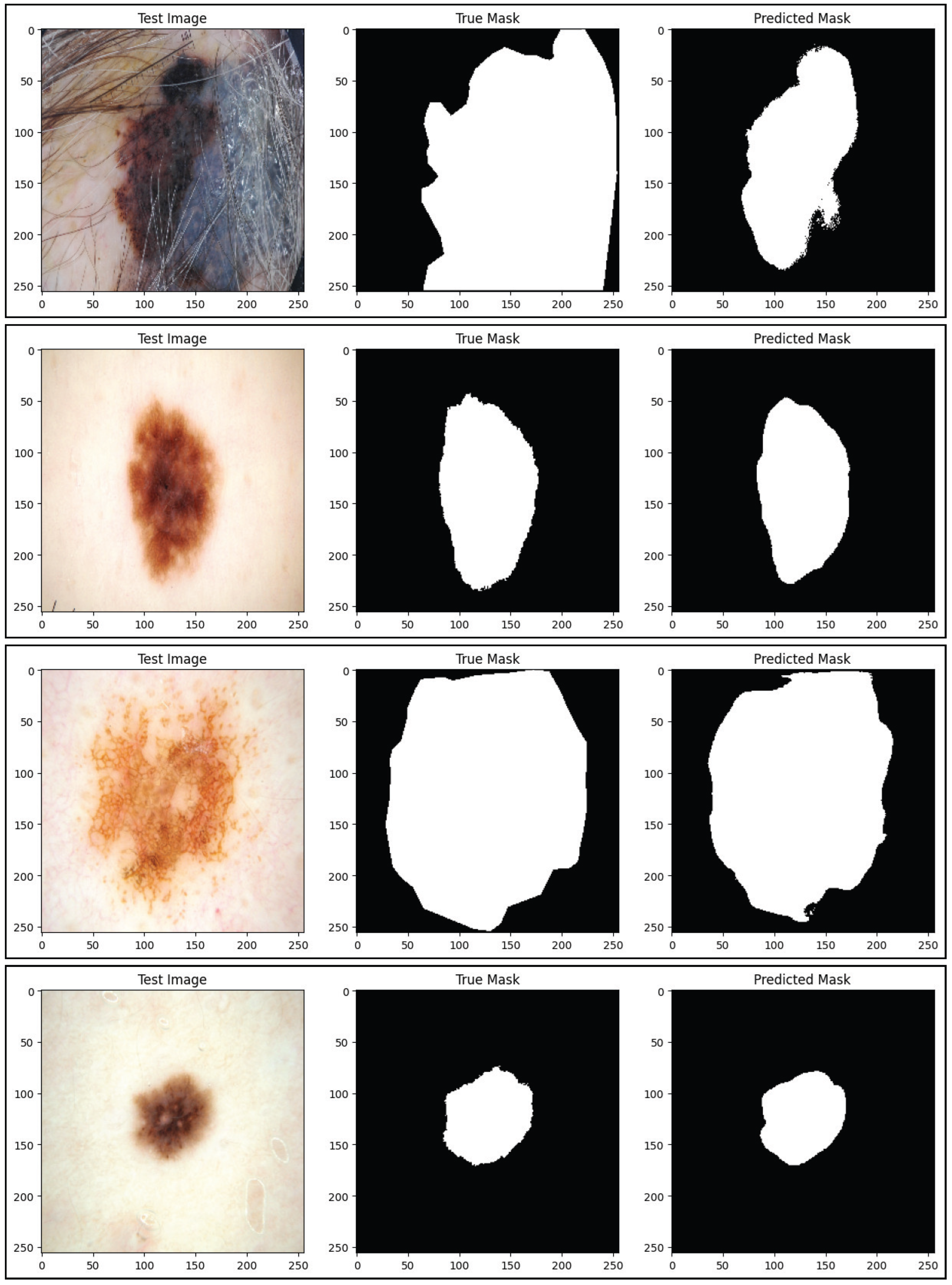 Foundation-Model-Driven Skin Lesion Segmentation and Classification ...