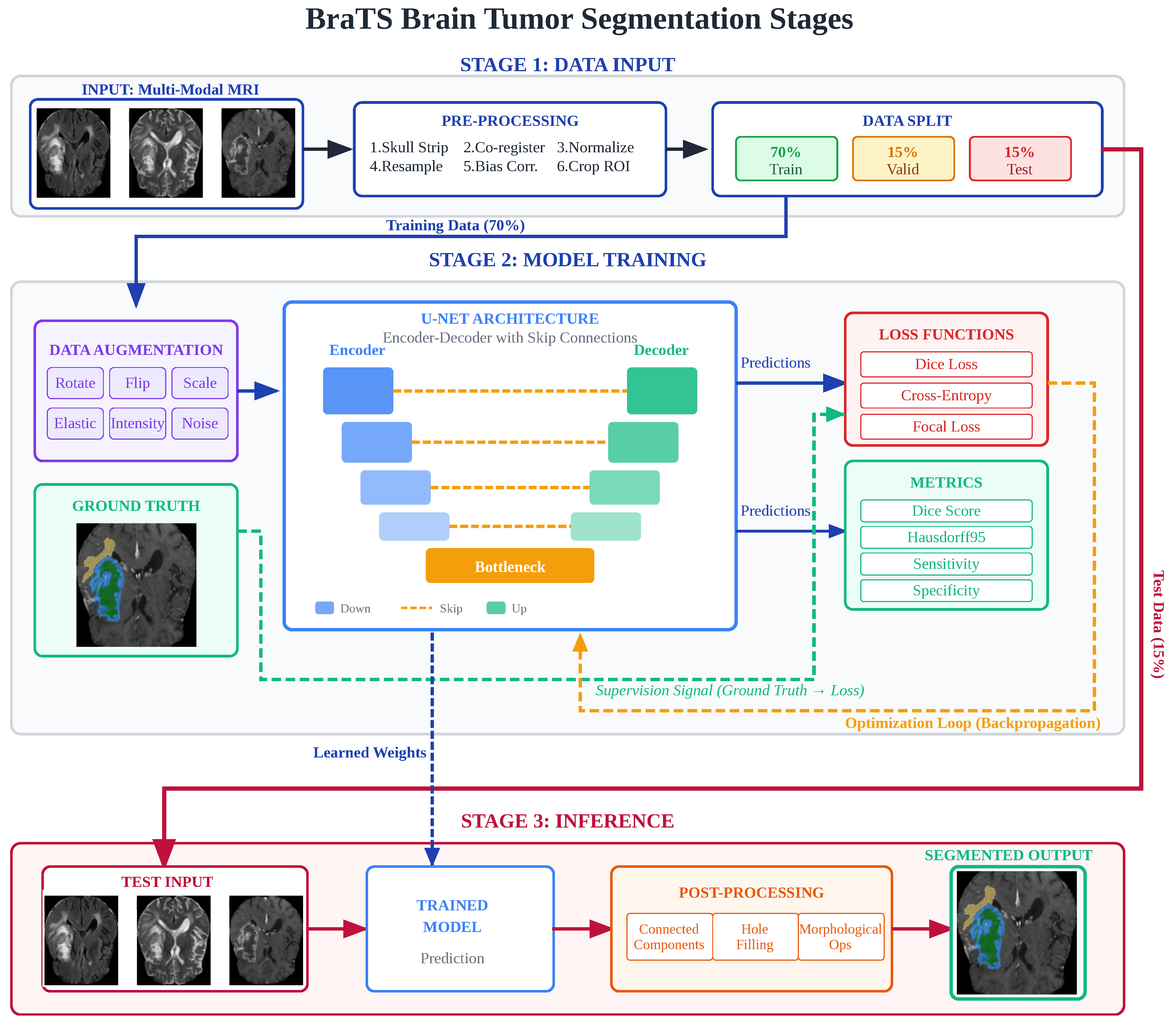 A Review of U-Net Based Deep Learning Frameworks for MRI-Based Brain ...