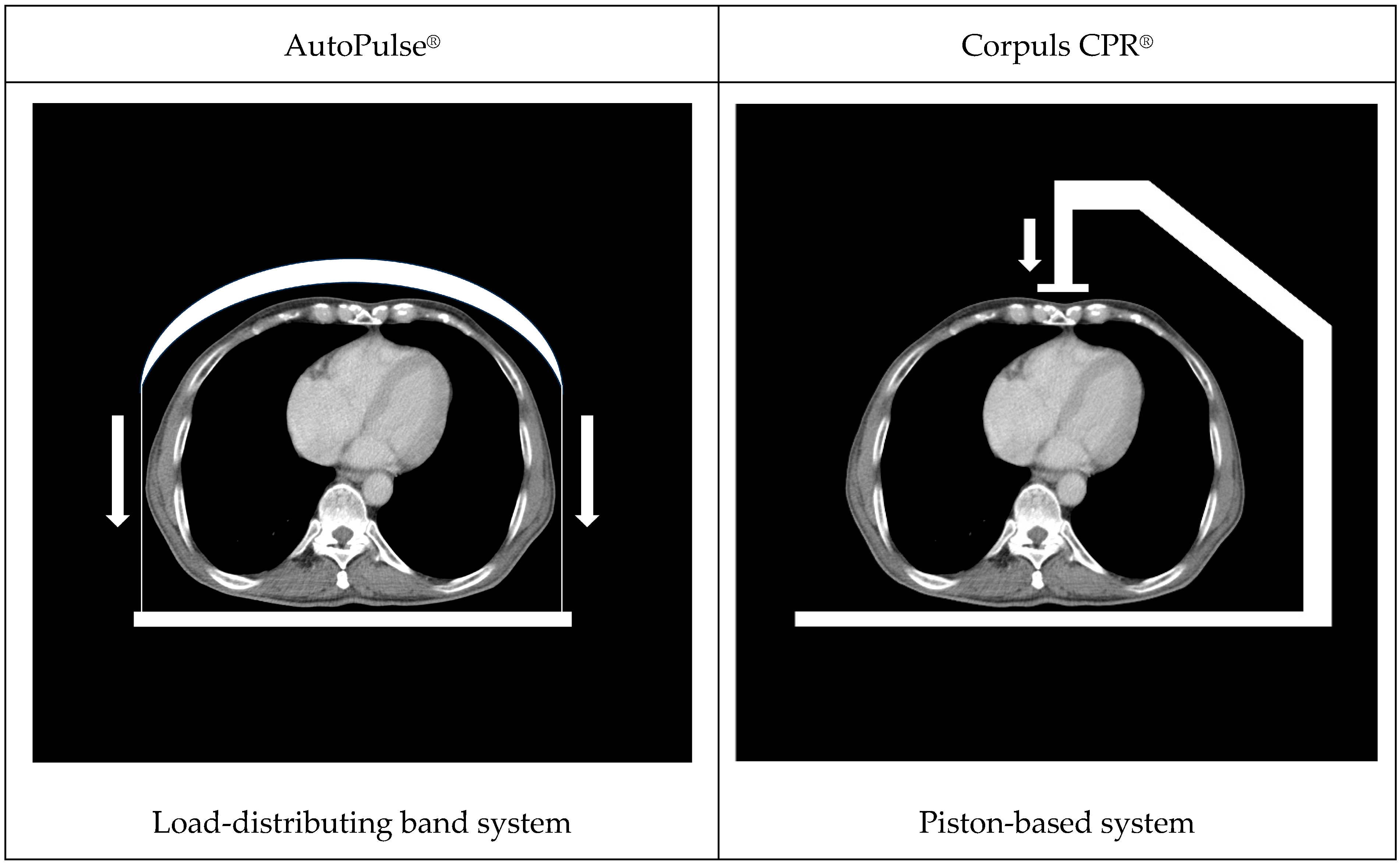Injury Patterns in Resuscitated Non-Traumatic Cardiac Arrest Patients—A ...