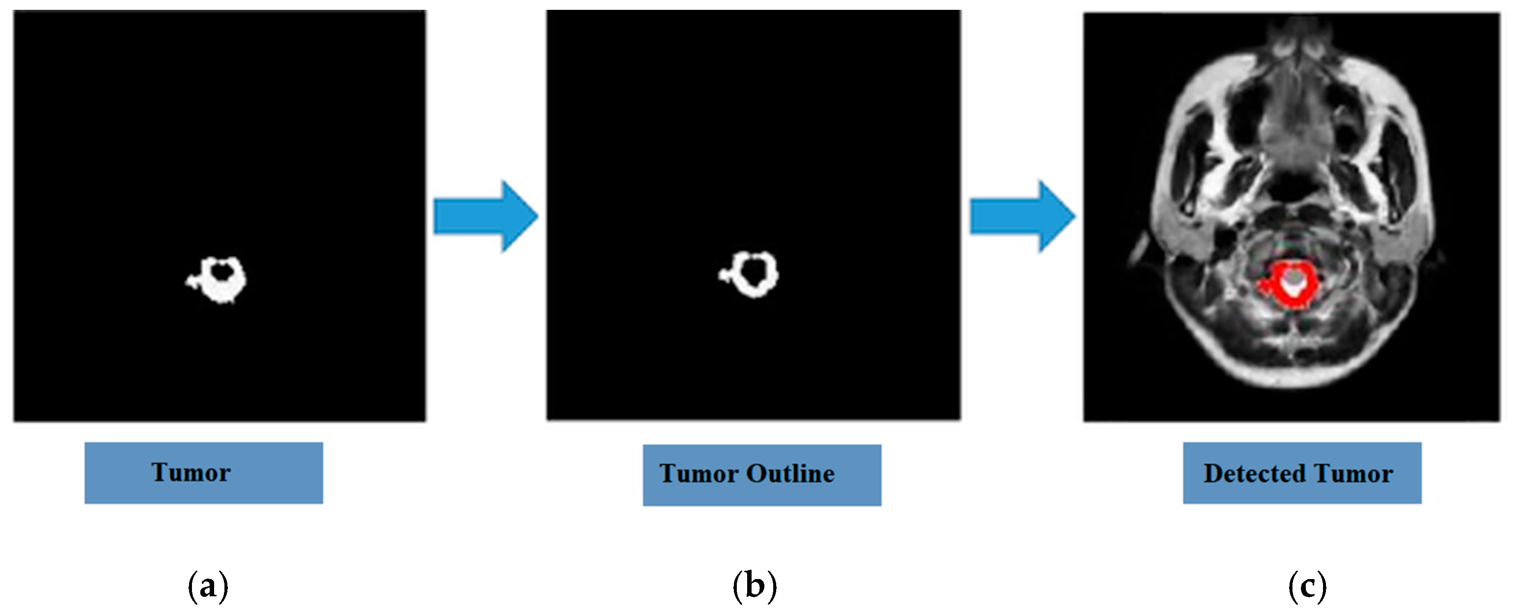 Hyperparameter Optimization of Convolutional Neural Networks for Robust ...