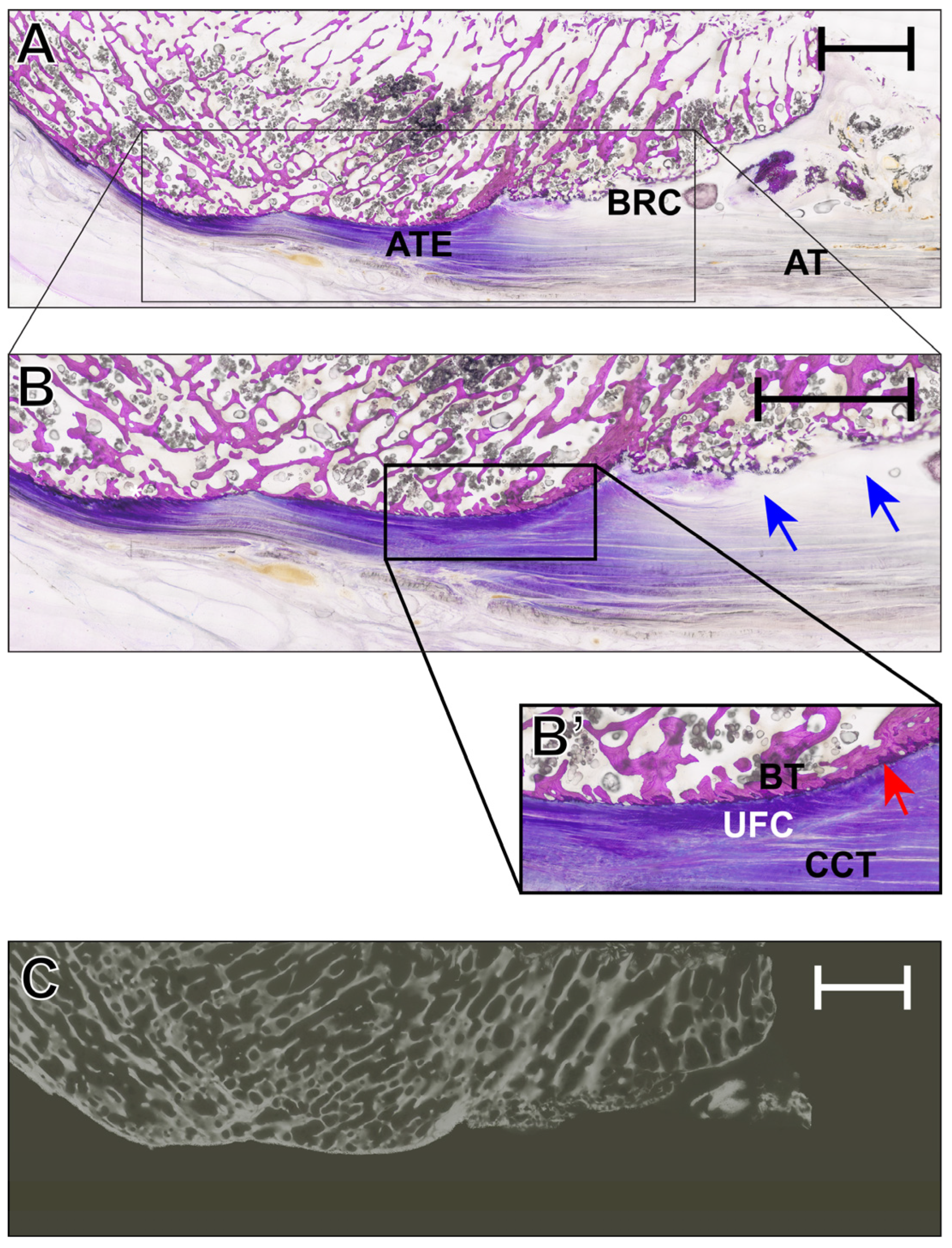 Visualizing the Achilles Tendon Enthesis: Translational Insights from 7 ...