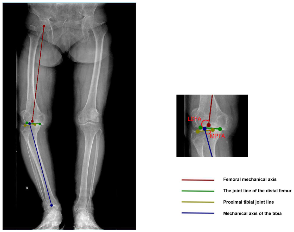 Deep Learning-Based Full-Process Automatic CPAK Classification System ...