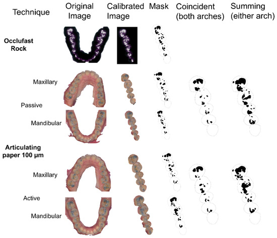 Clinical Strategies to Improve the Accuracy of Articulating Paper for Detecting Occlusal Contact Points in Adults with Natural Dentitions