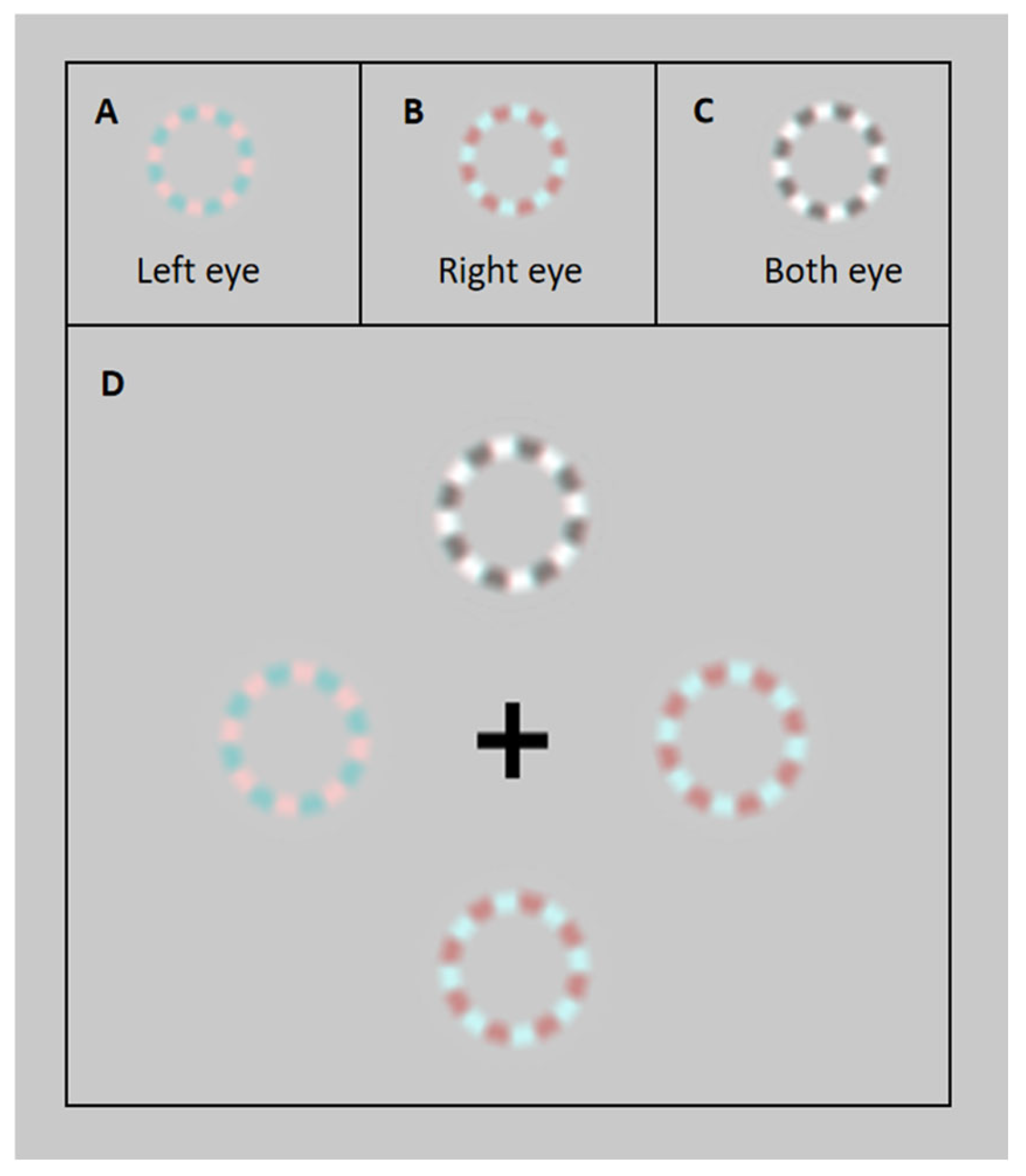 A Novel Test of Dynamic Visual Function: Comparison Between Presbyopic ...