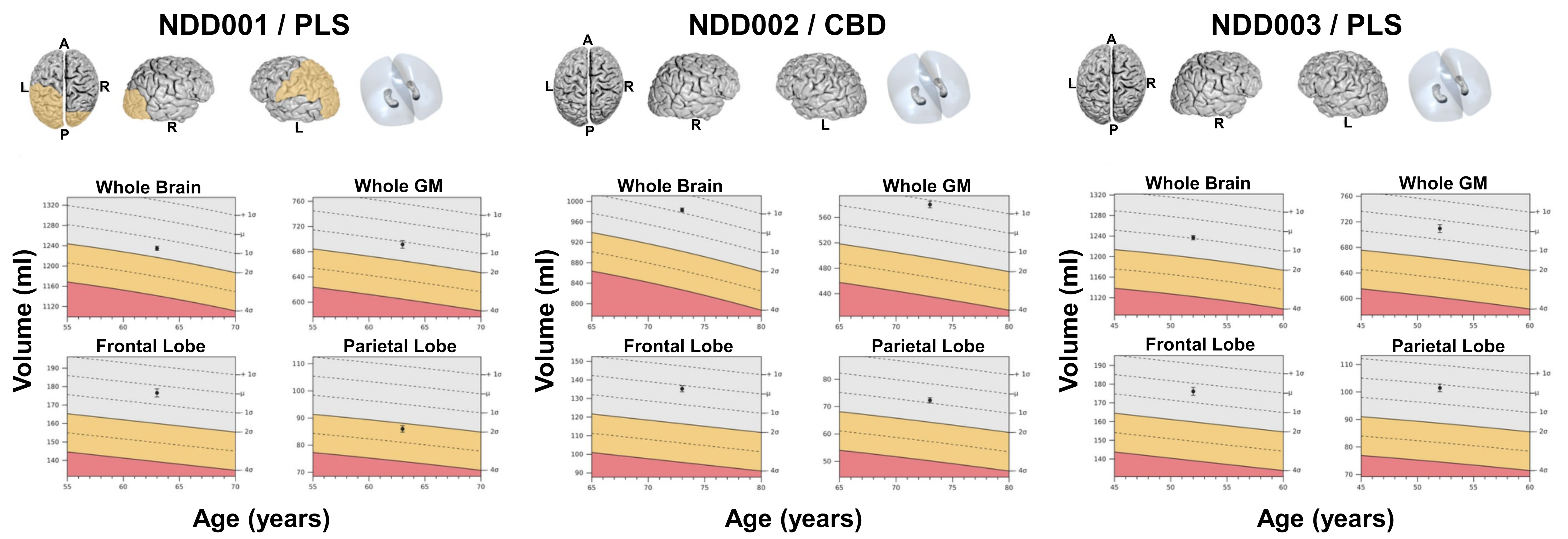 Integrating Metabolic, Perfusion, and Microstructural Parameters for ...