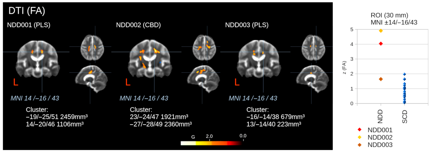 Integrating Metabolic, Perfusion, and Microstructural Parameters for ...