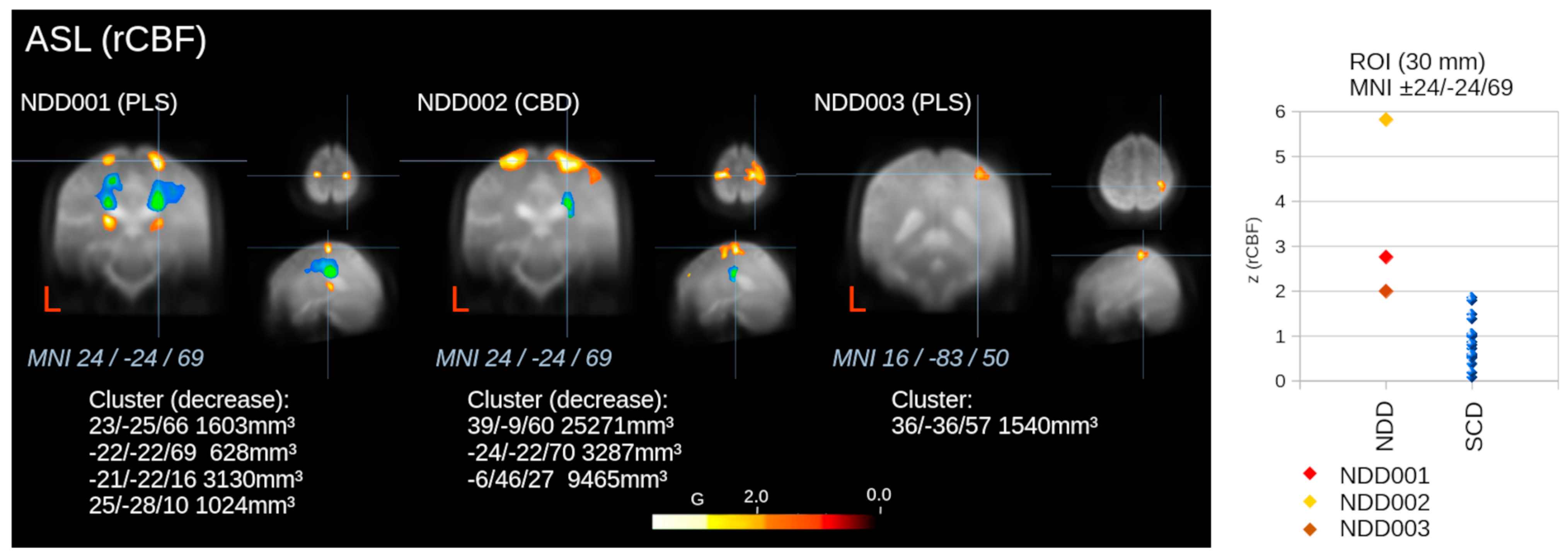 Integrating Metabolic, Perfusion, and Microstructural Parameters for ...