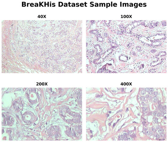 An Explainable Disease-Aware Intelligent Histopathological ...