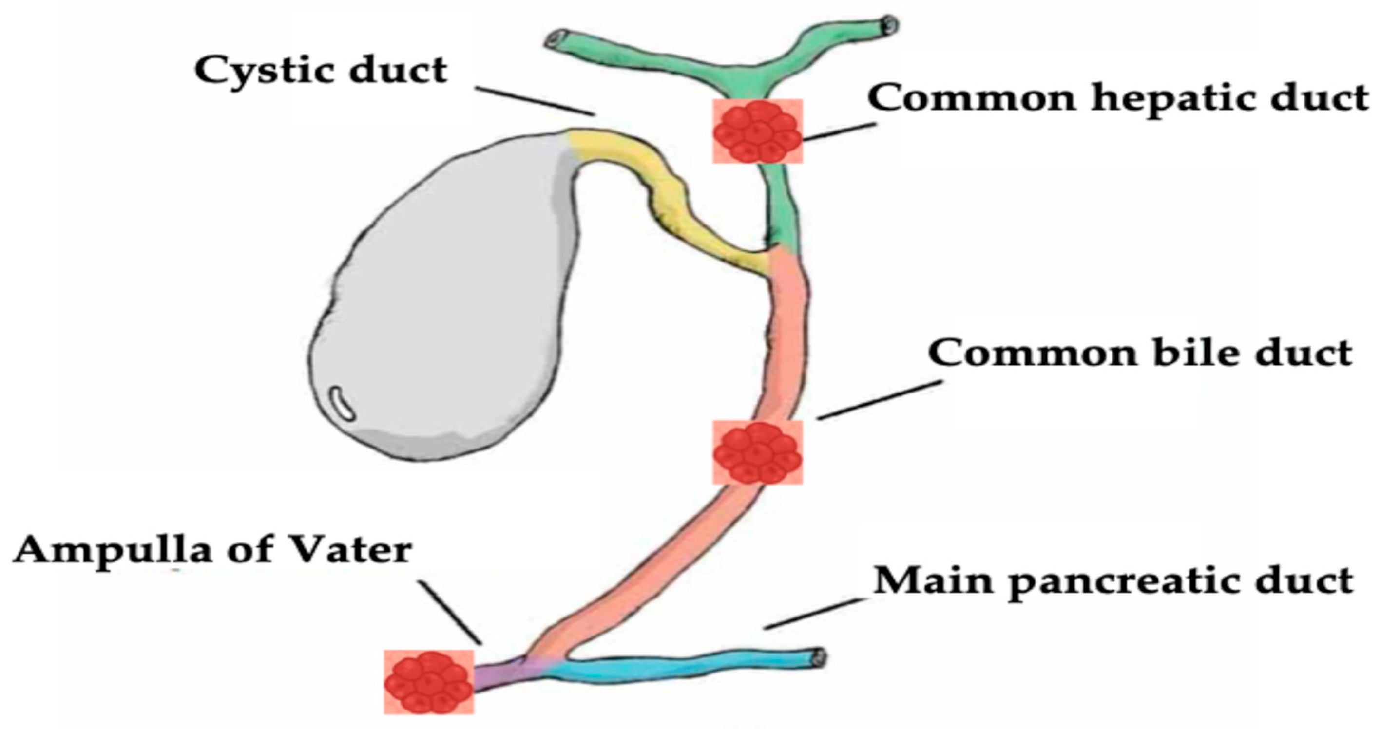 Endobiliary Radiofrequency Ablation for Hepato-Biliary