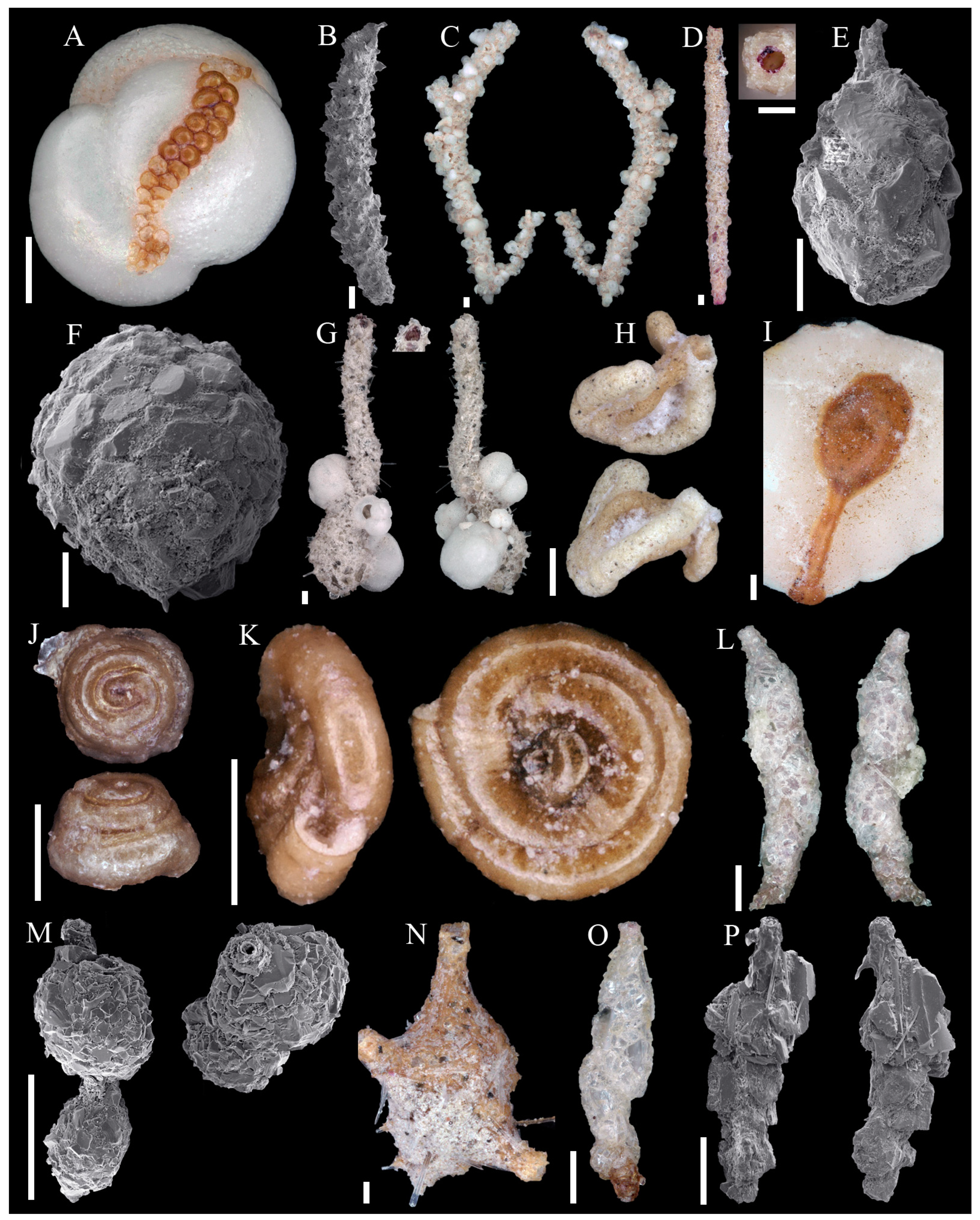 Diversity Free Full-Text | Benthic Foraminifera Diversity of the Abyssal Northwest Atlantic