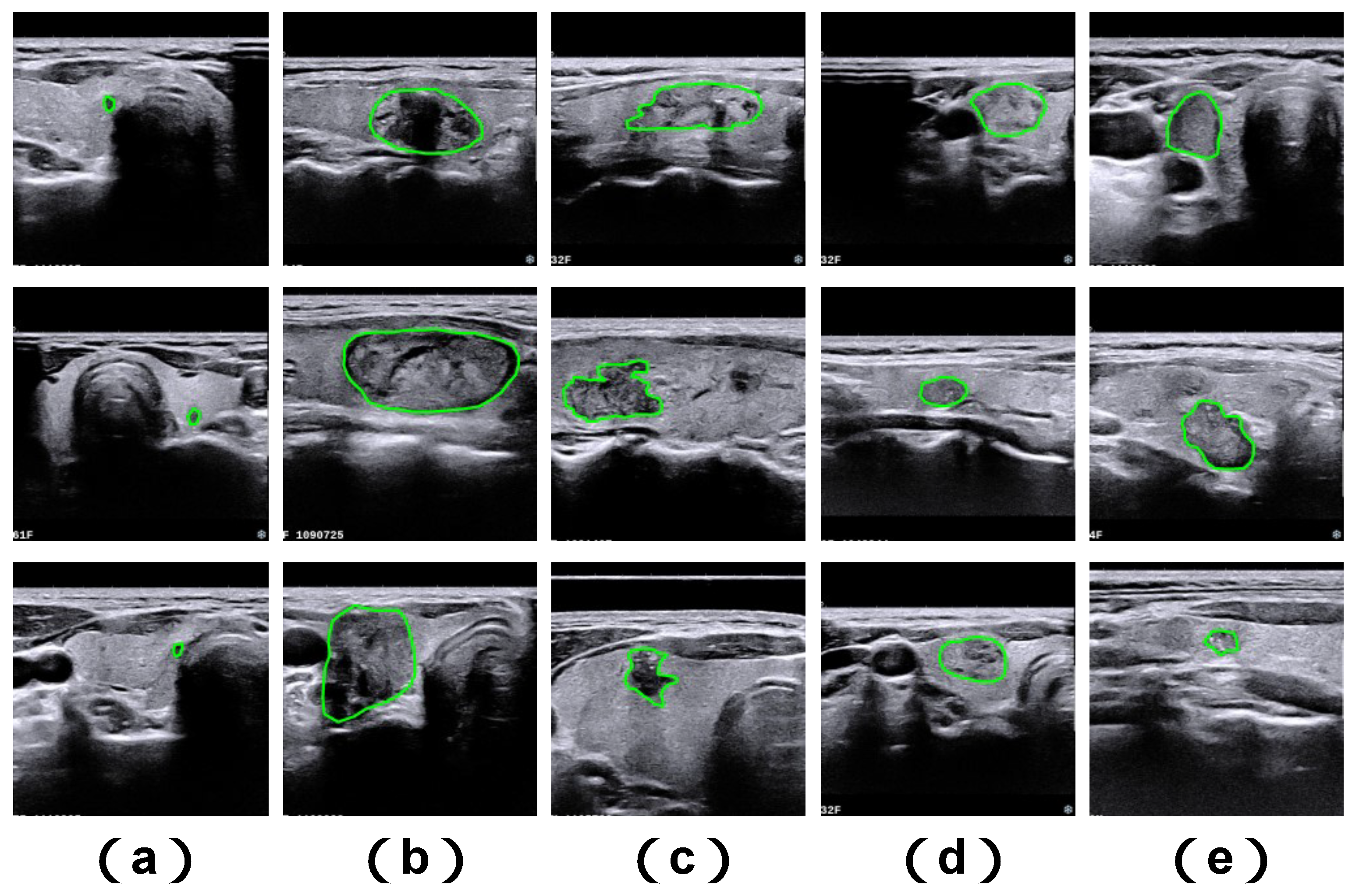 MFA-Net: Multiscale Feature Attention Network for Medical Image ...
