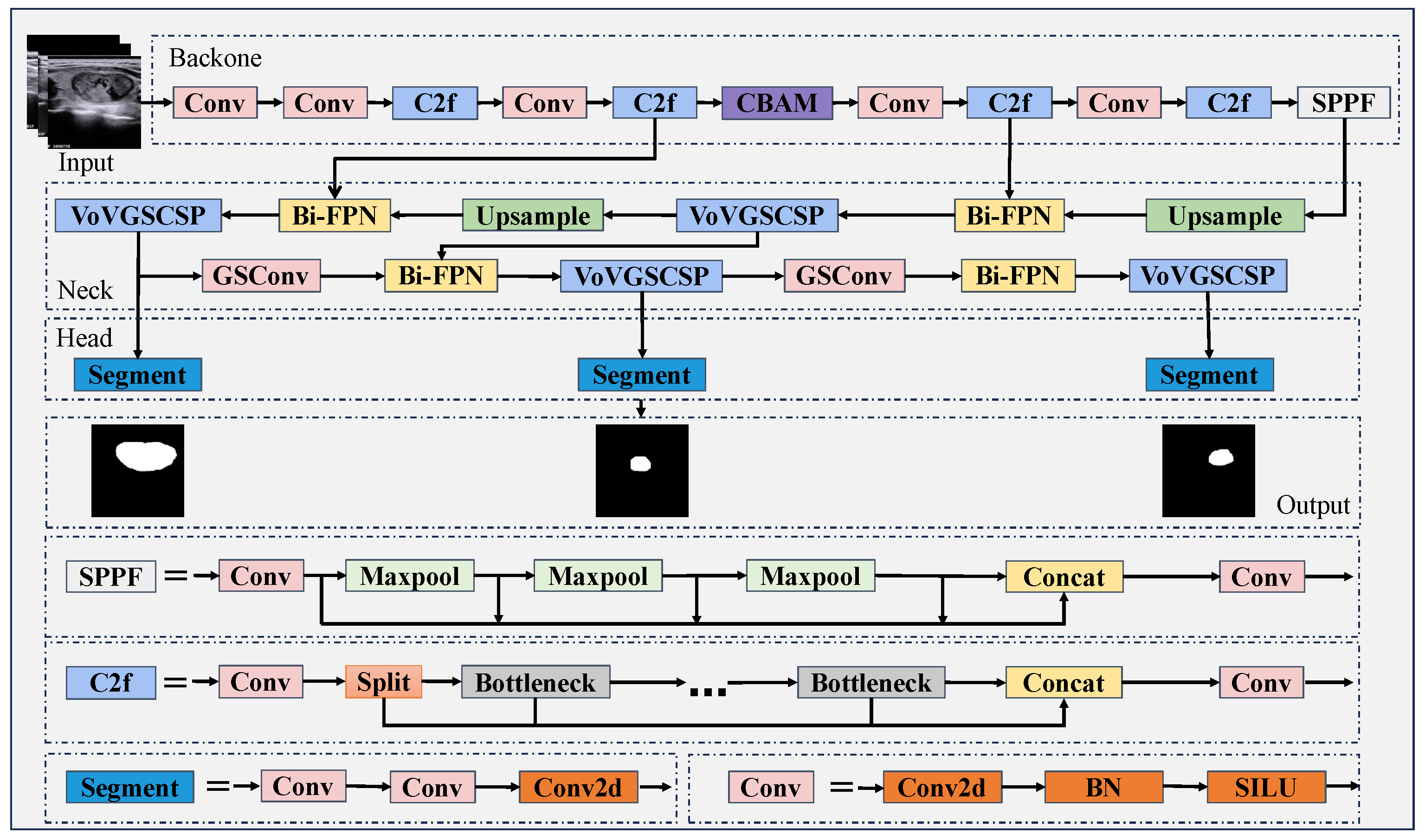 MFA-Net: Multiscale Feature Attention Network for Medical Image ...