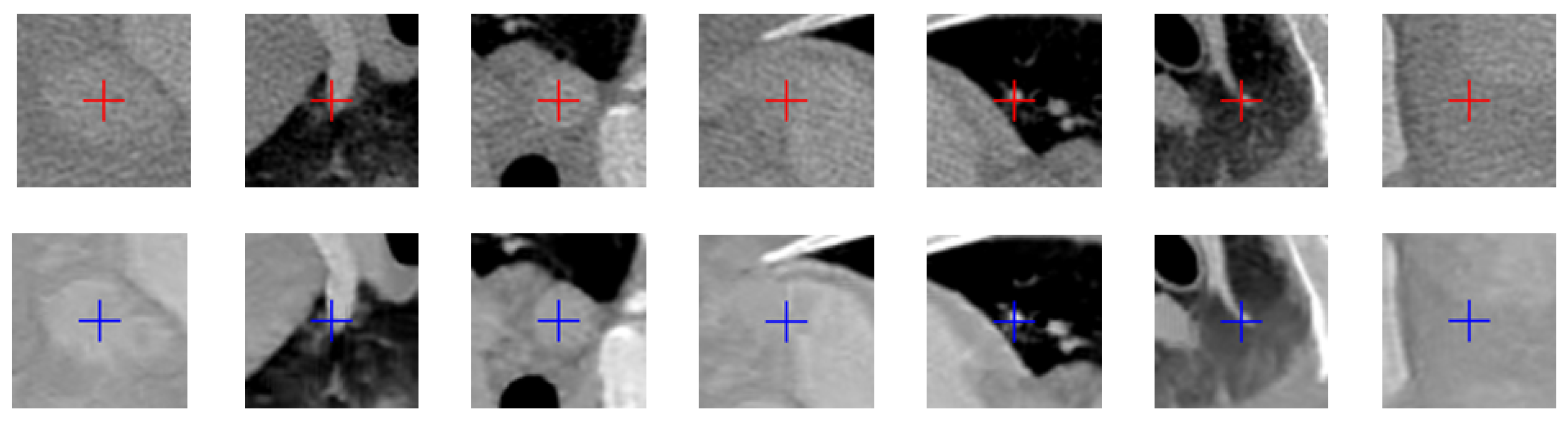 Residual Motion Correction in Low-Dose Myocardial CT Perfusion Using ...