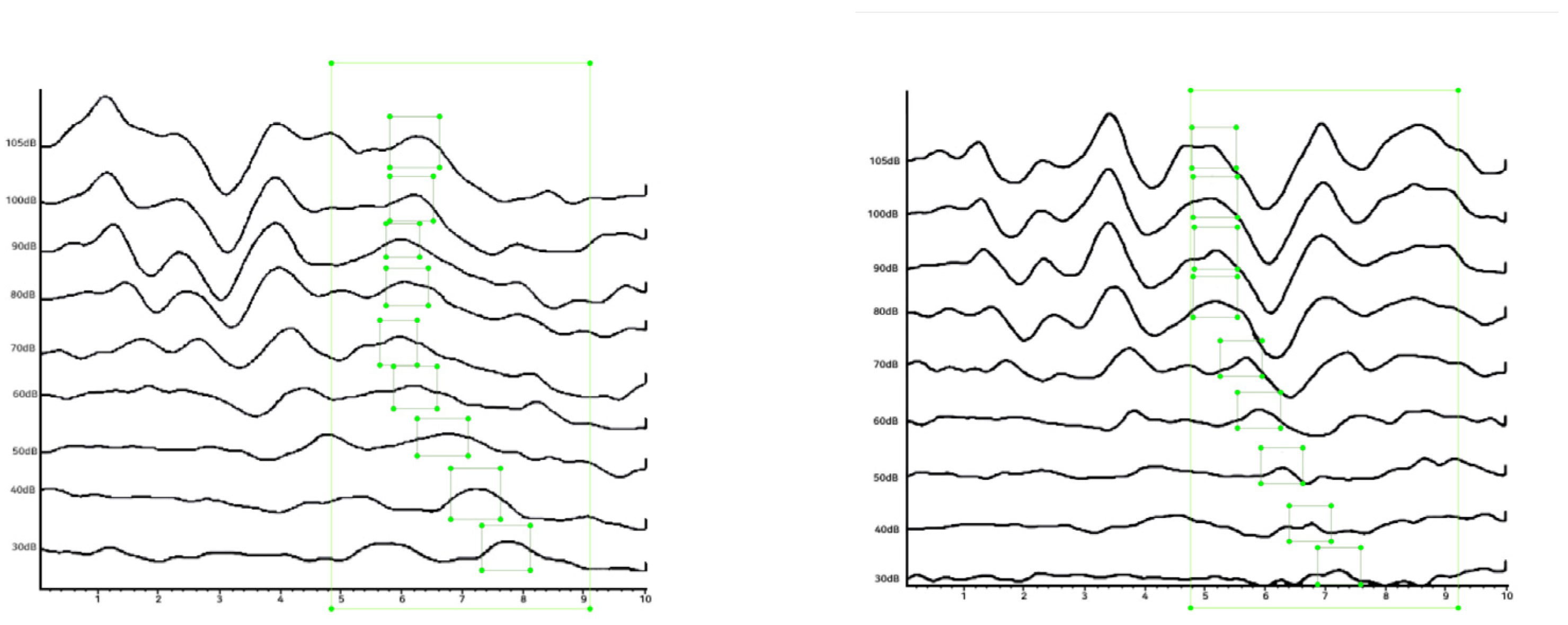 A Deep Learning Model for Wave V Peak Detection in Auditory Brainstem ...