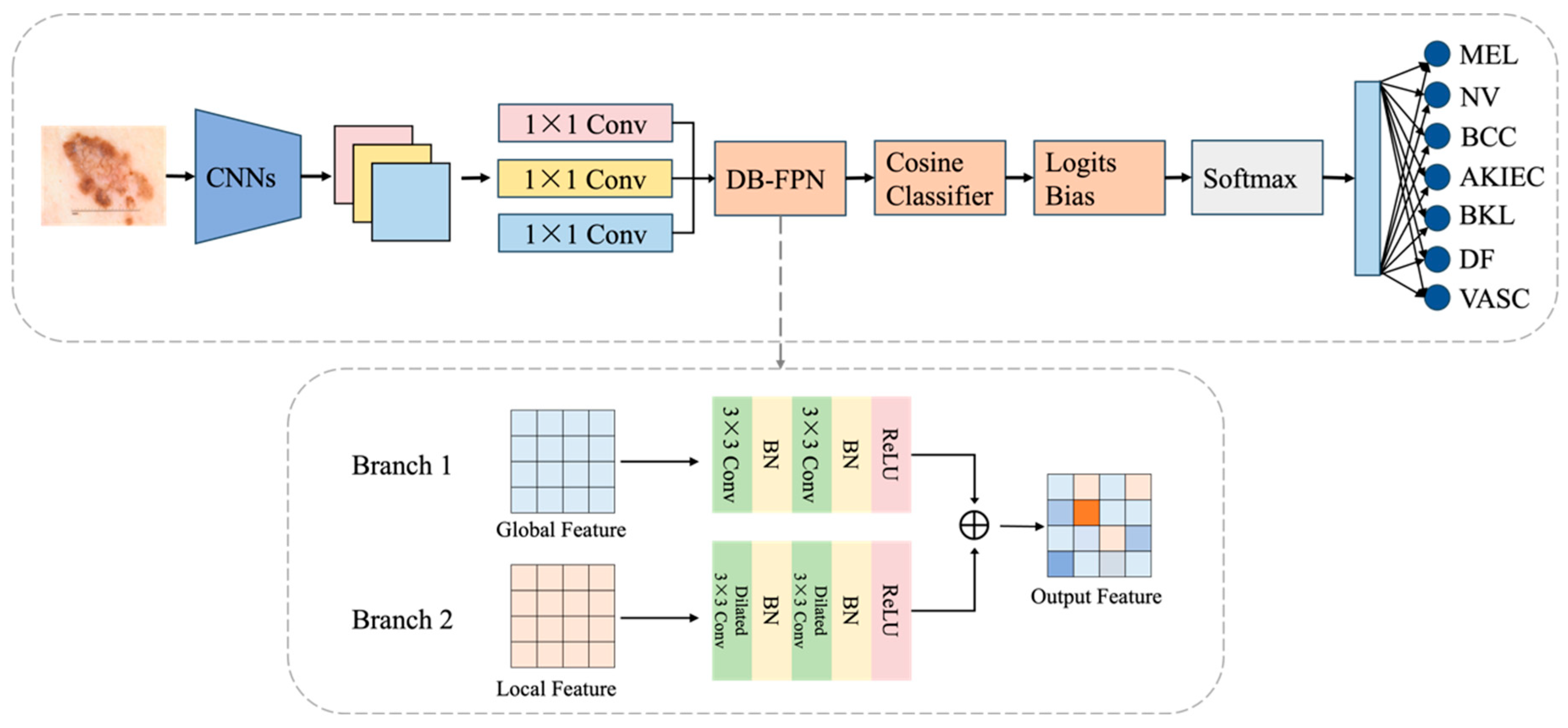 A Dual-Branch Multi-Scale Network for Skin Lesion Classification