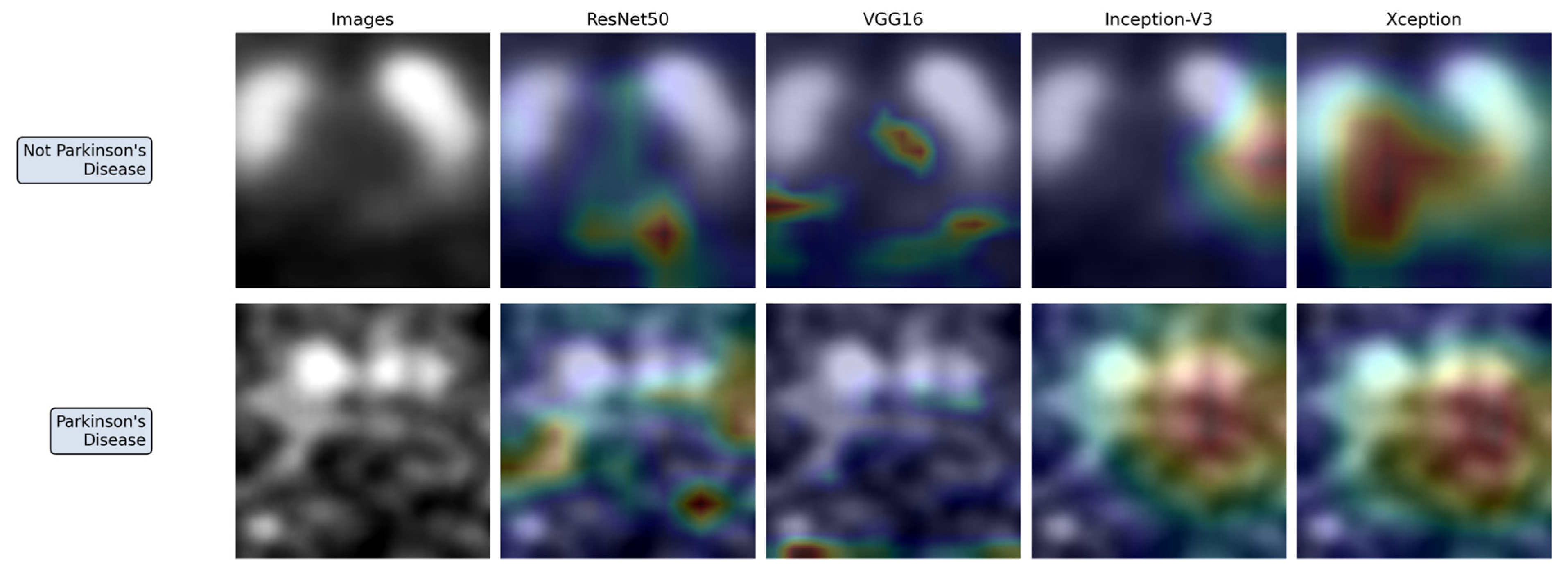 Dat Spect Inparkinson Revisiting CNN-Based Parkinson’s Disease Classification from DaT-SPECT ...