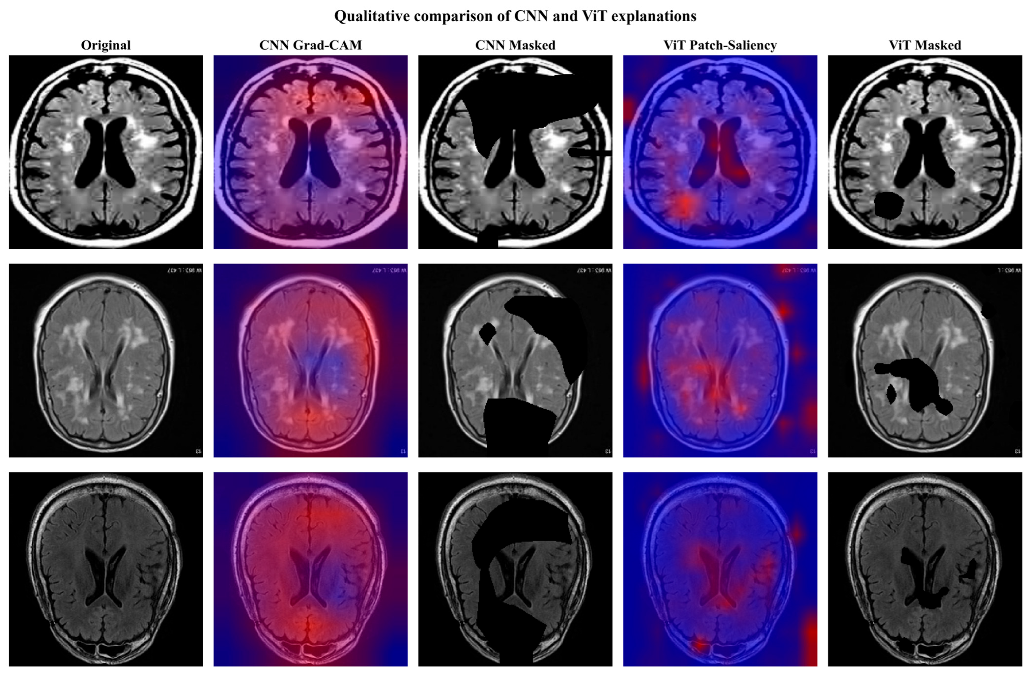 A Quantitative Evaluation of Gradient-Based Visual Explainability ...