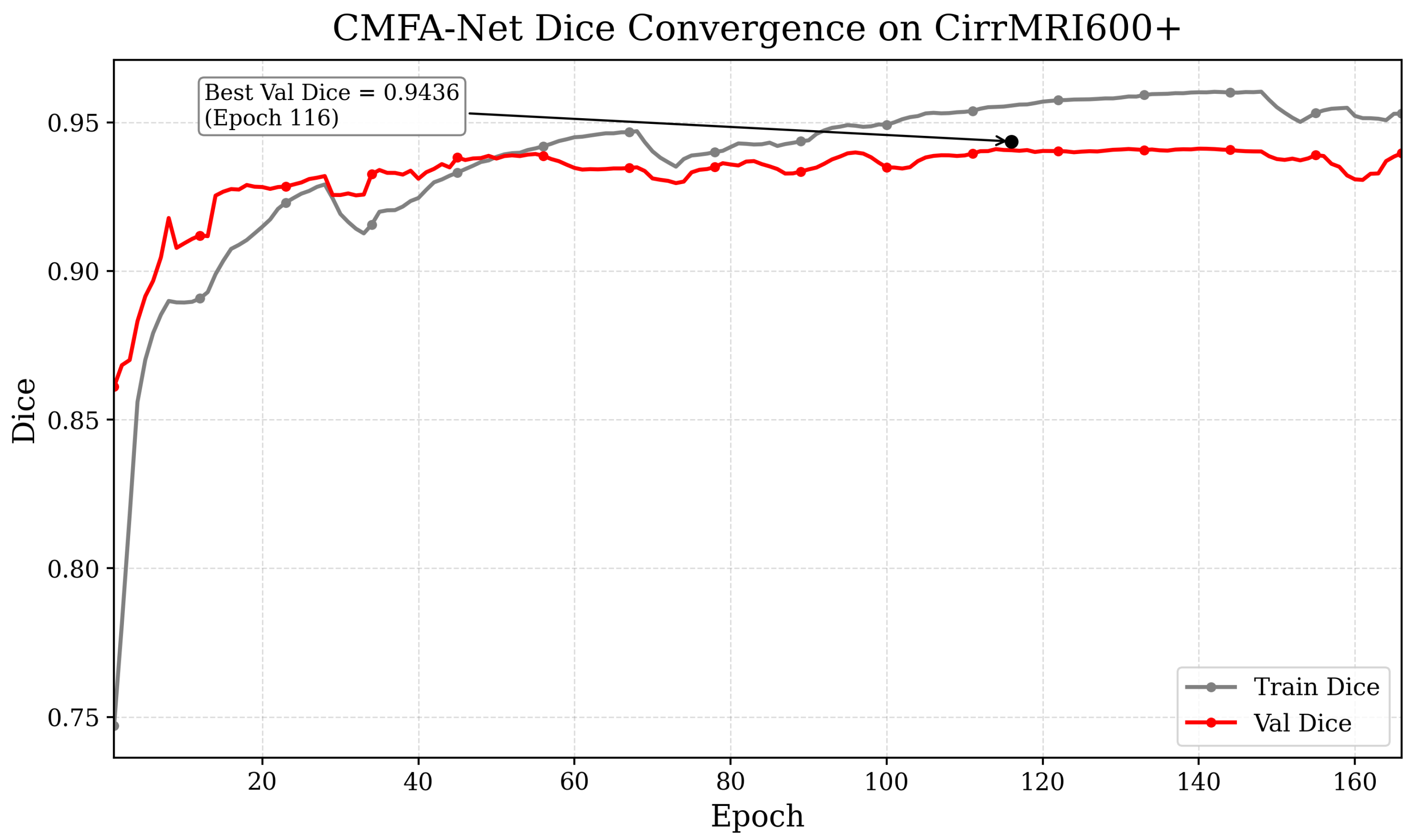 CMFA-Net: A CNN–Mamba Collaborative Feature Alignment Network for ...