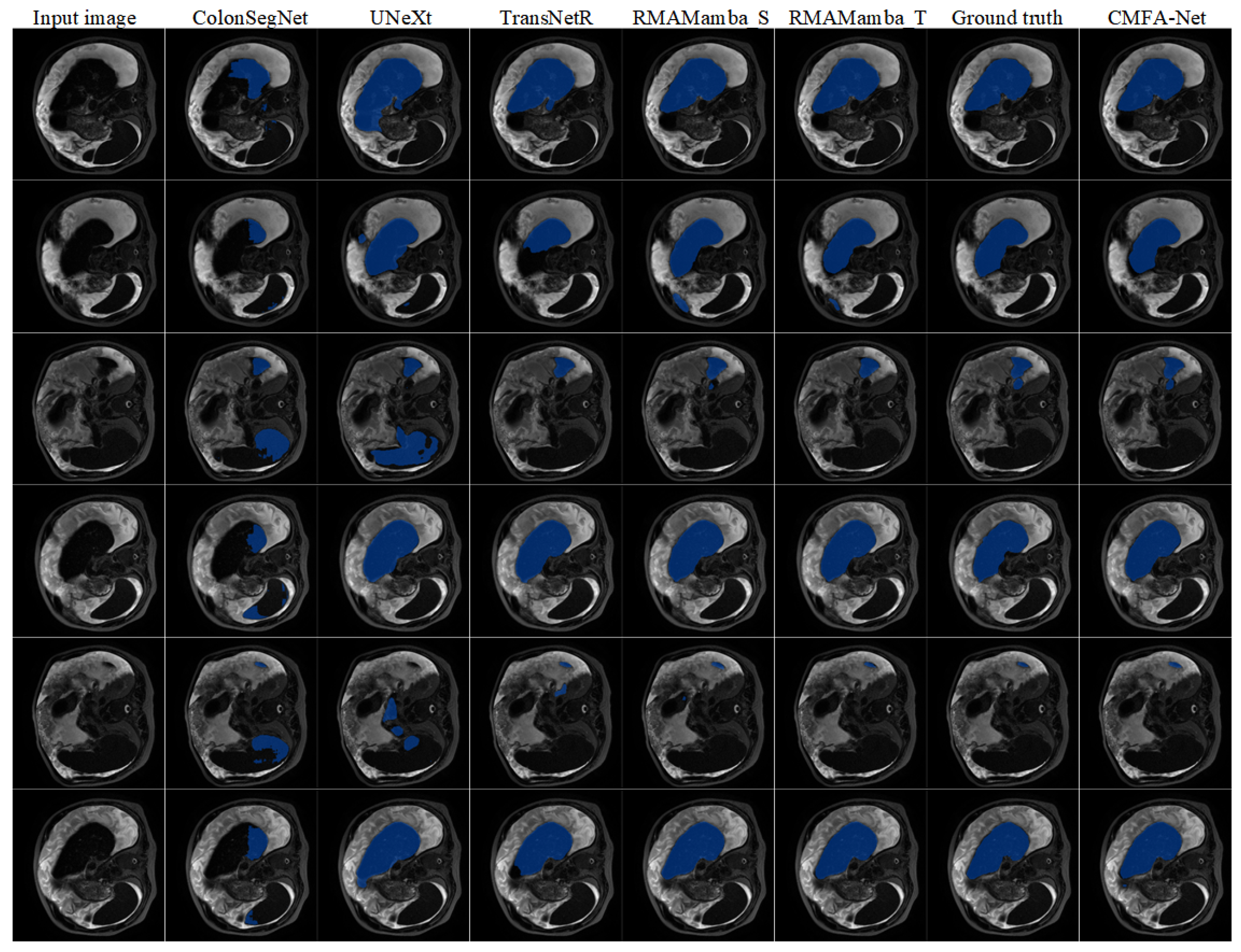 CMFA-Net: A CNN–Mamba Collaborative Feature Alignment Network for ...