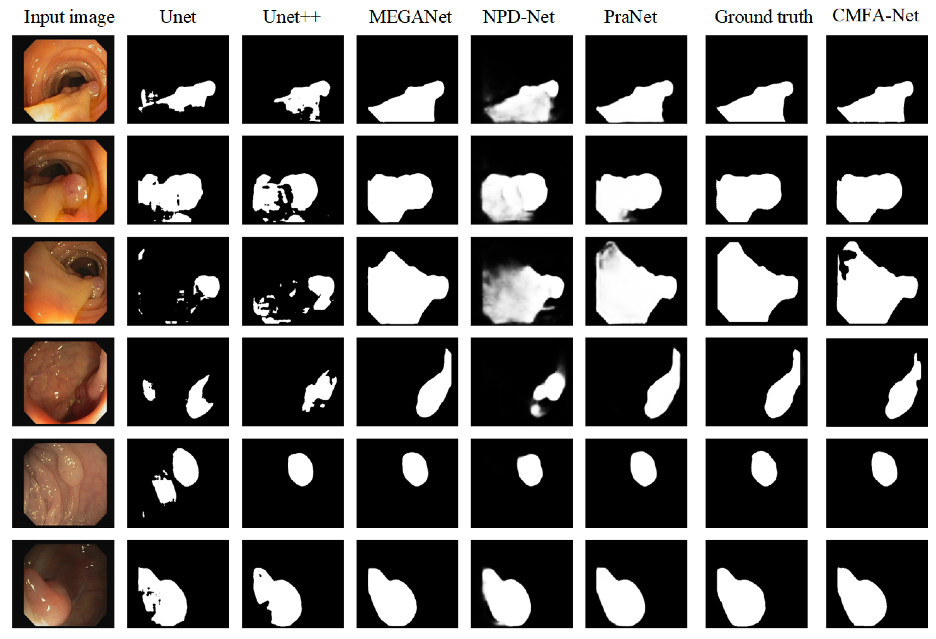 CMFA-Net: A CNN–Mamba Collaborative Feature Alignment Network for ...