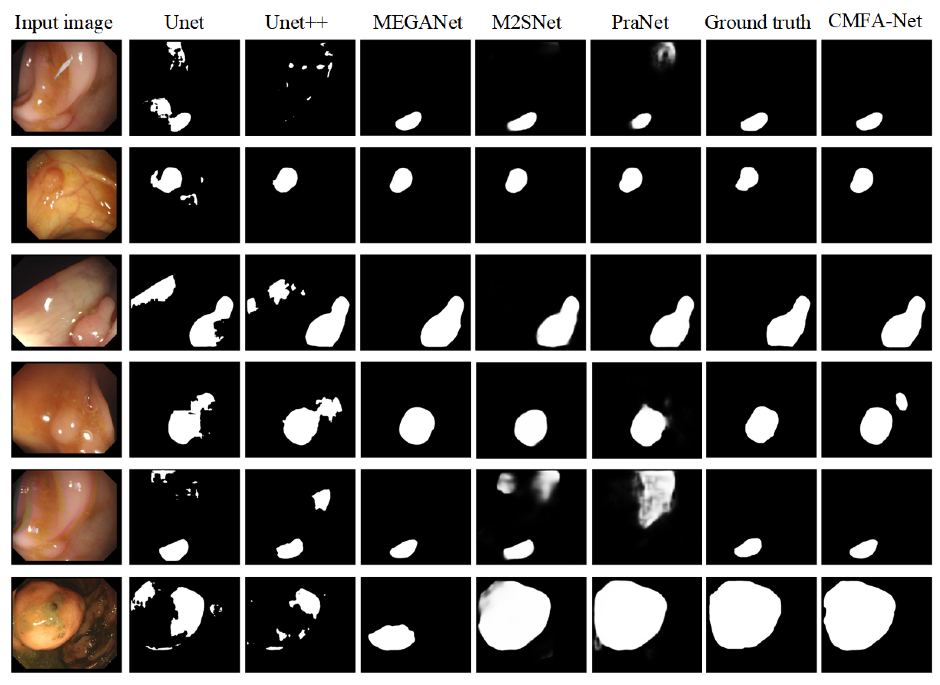 CMFA-Net: A CNN–Mamba Collaborative Feature Alignment Network for ...